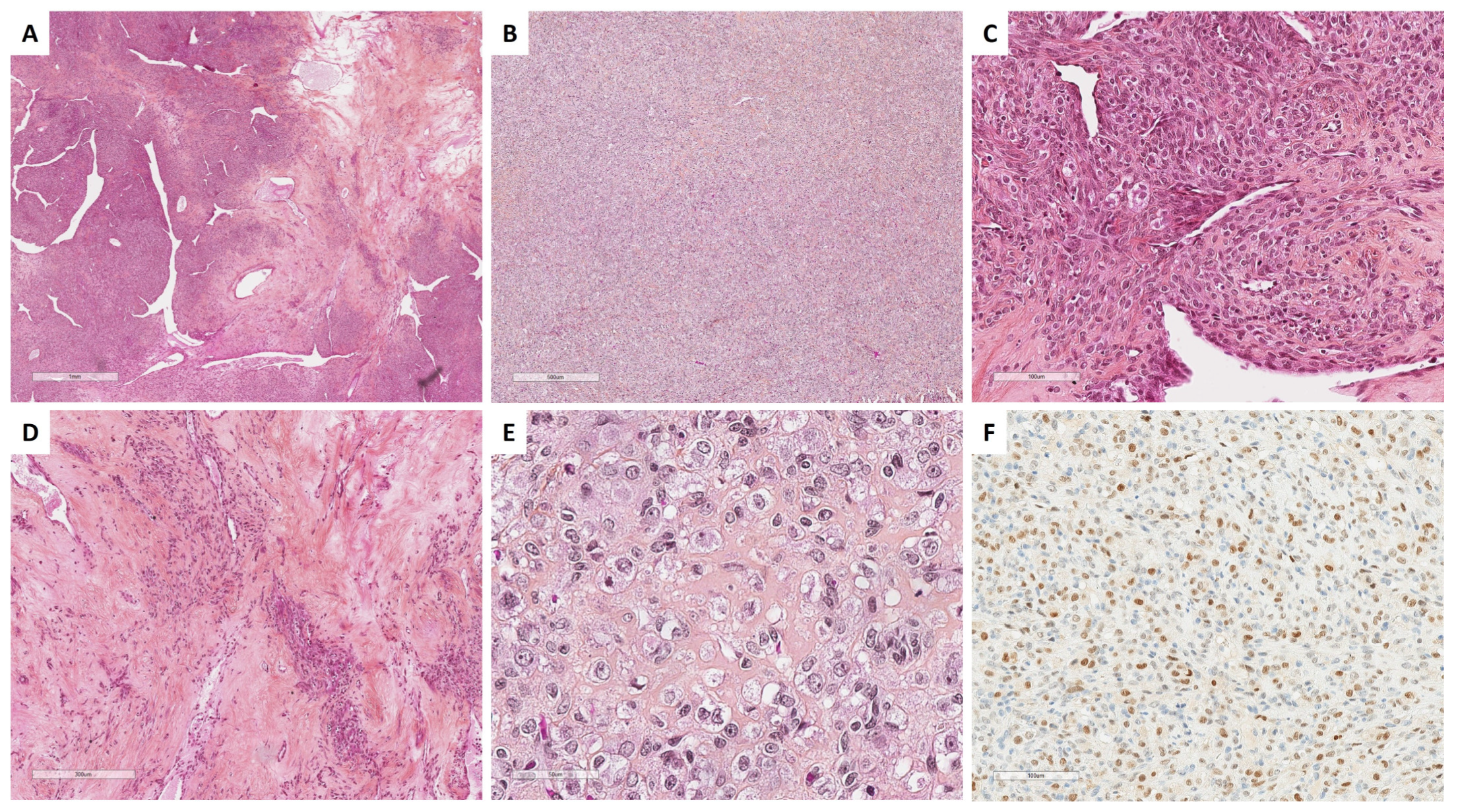 Cancers 15 05864 g004 Cancers 15 05864 g004