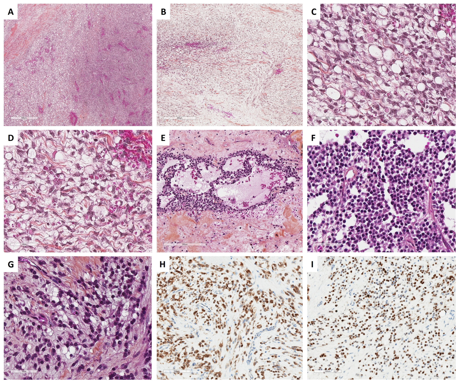 Cancers 15 05864 g005 Cancers 15 05864 g005