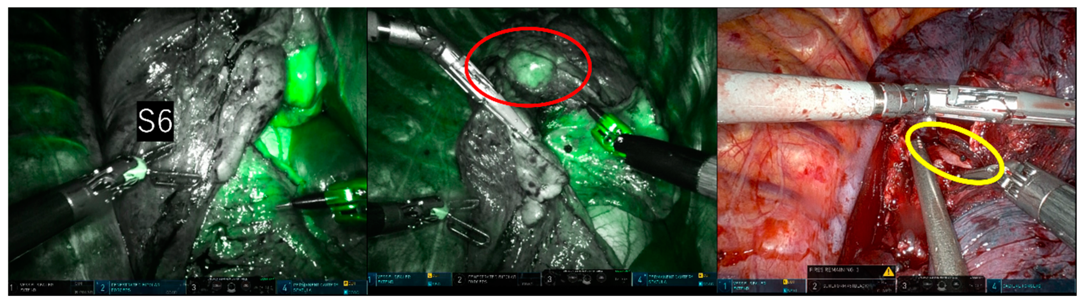 Cancers 15 05876 g004