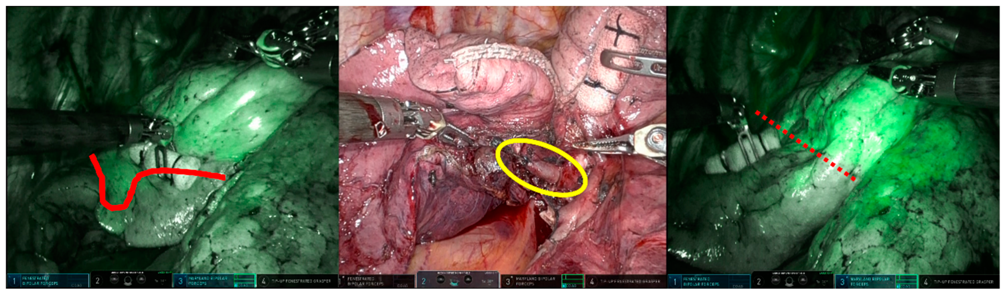 Cancers 15 05876 g005