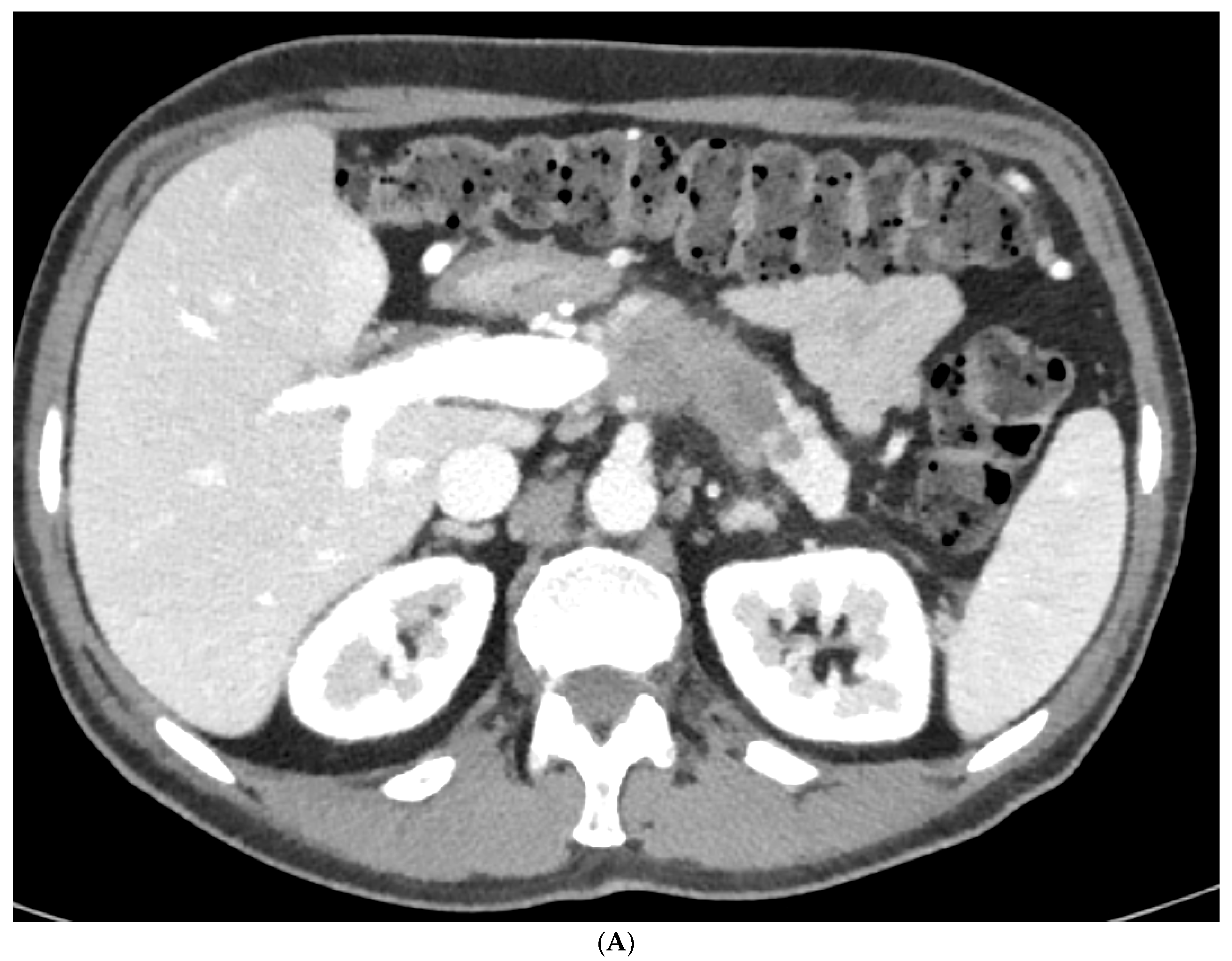 Cancers 15 05881 g001a