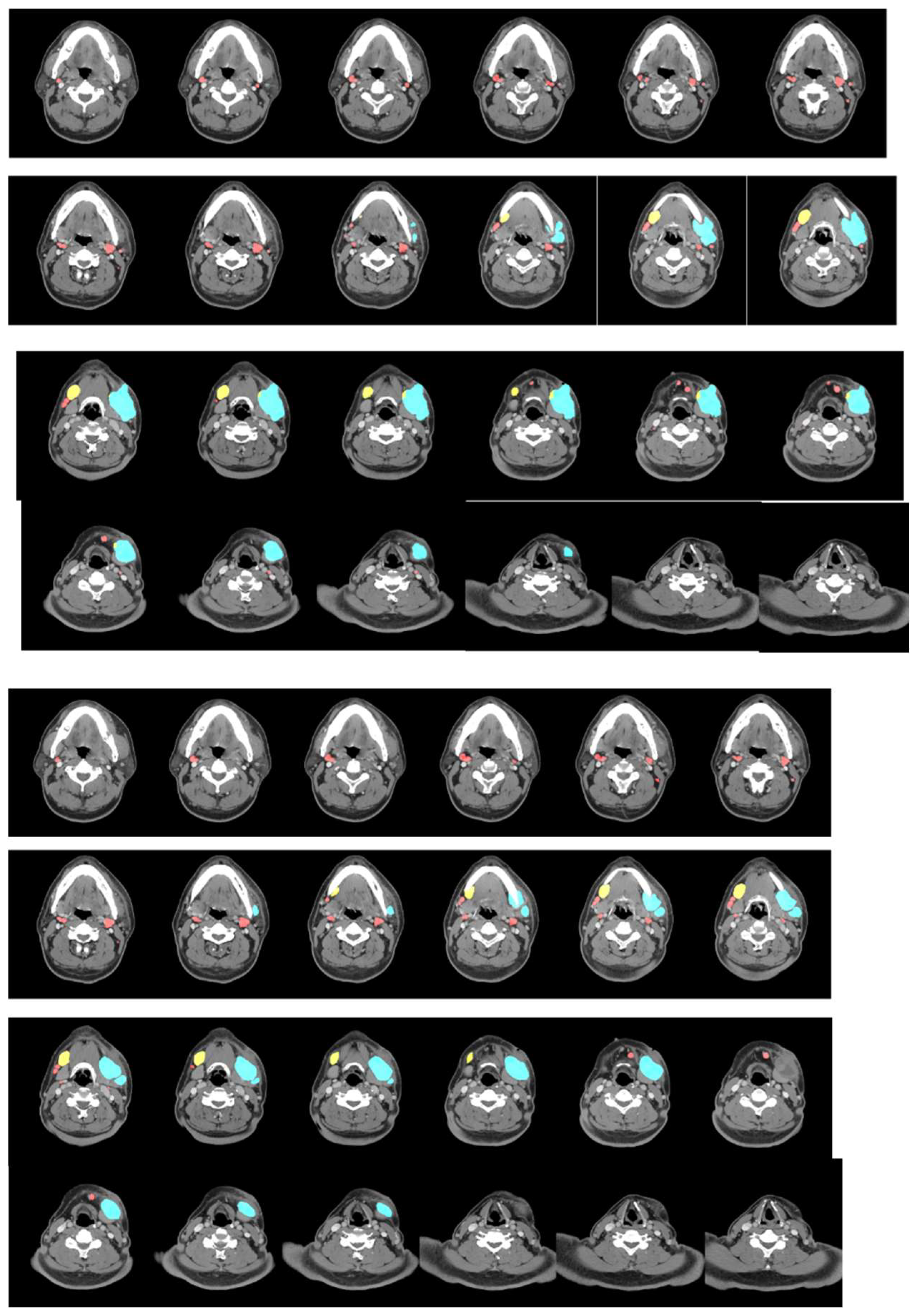 Cancers 15 05890 g002a