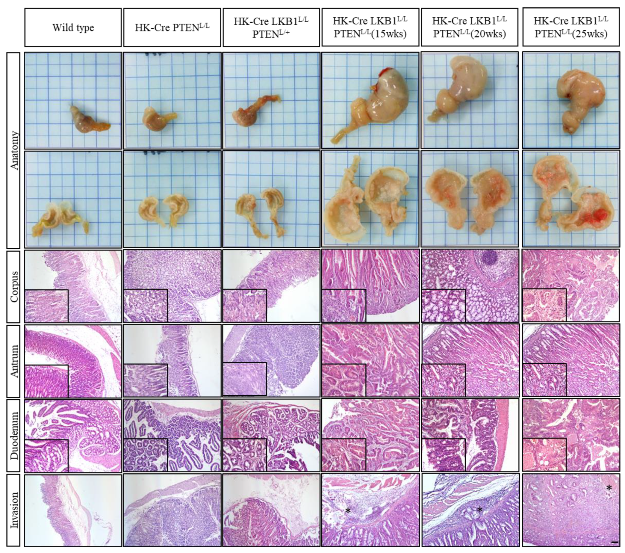 Cancers 15 05893 g003