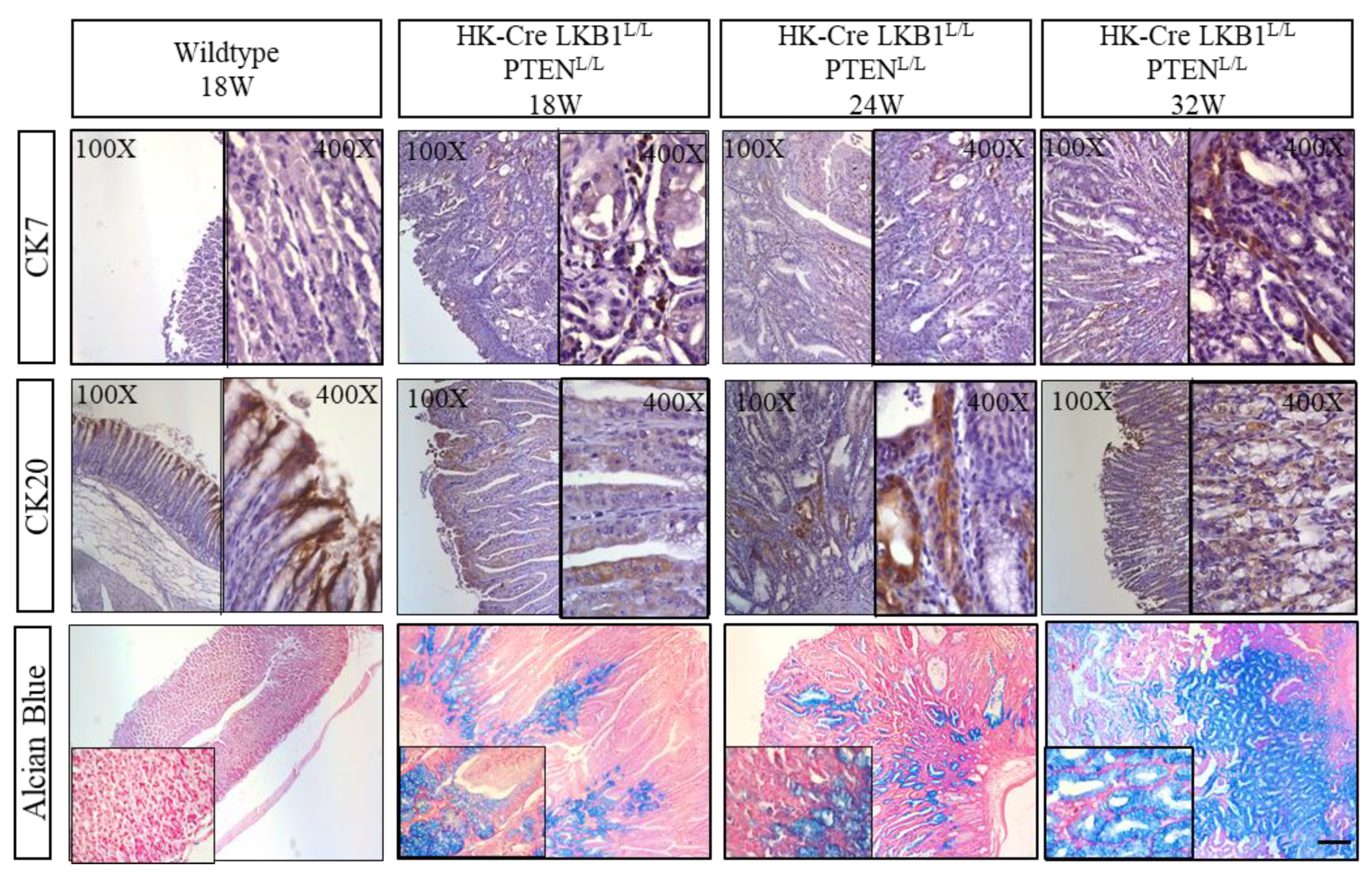Cancers 15 05893 g005