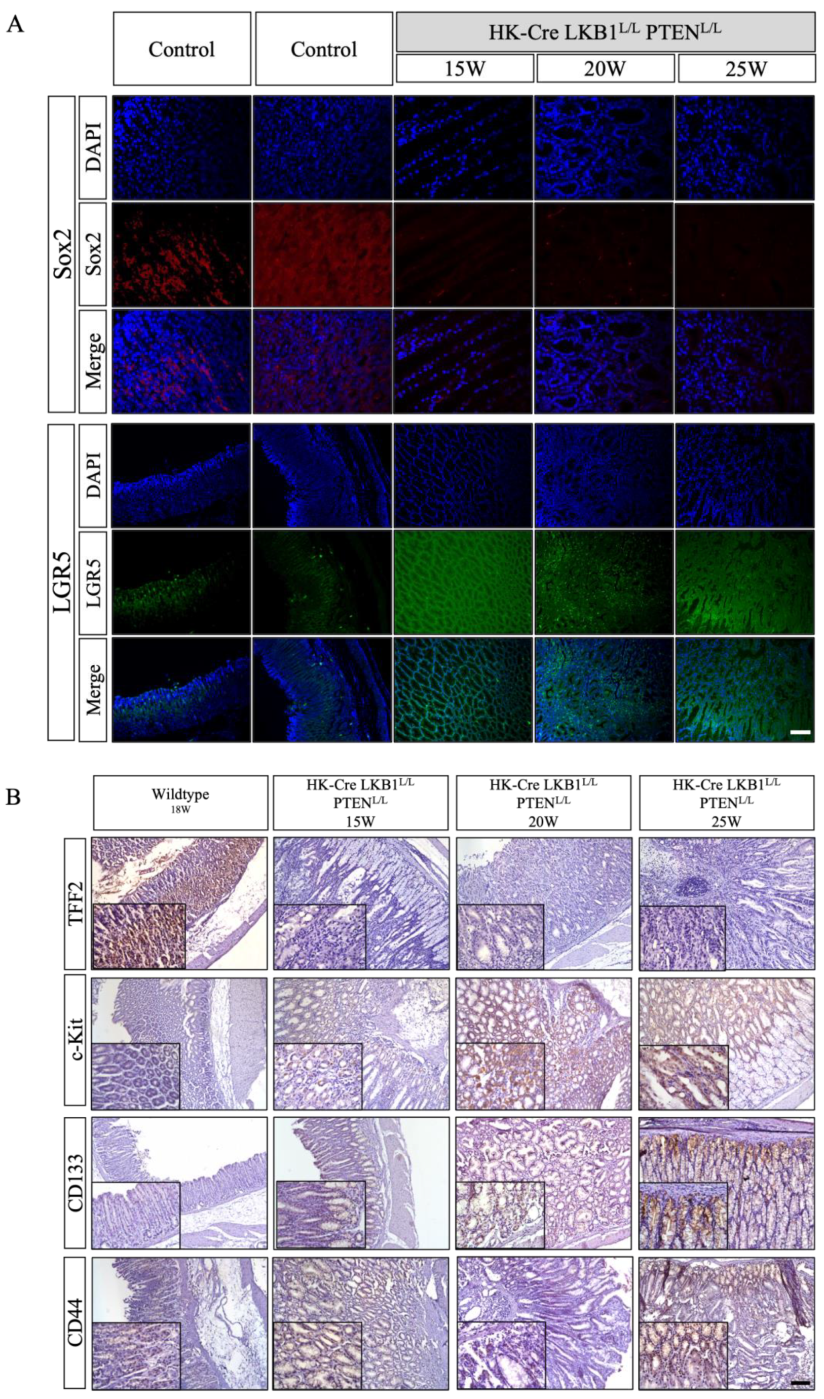 Cancers 15 05893 g008