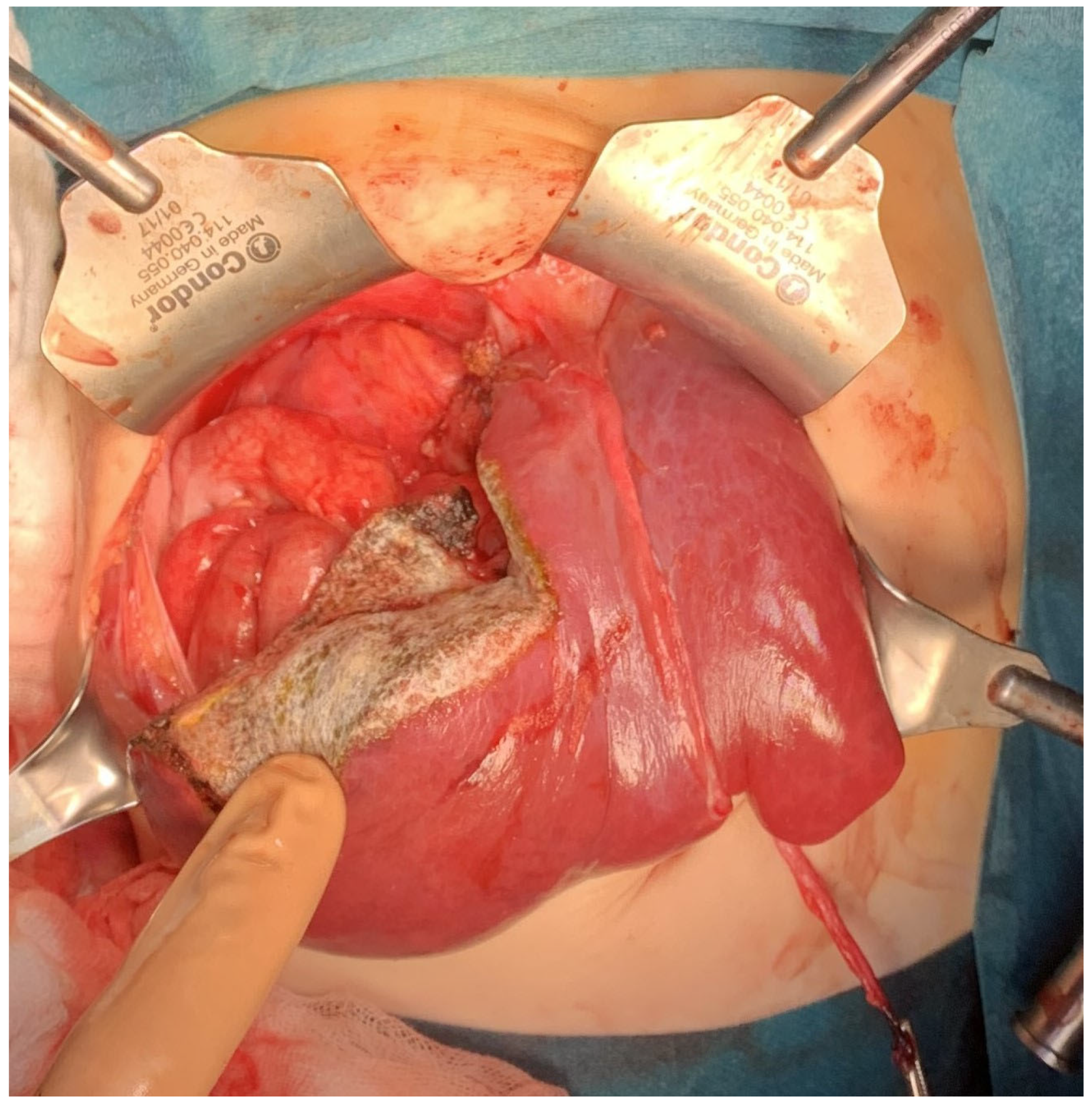 Cancers 16 00038 g002