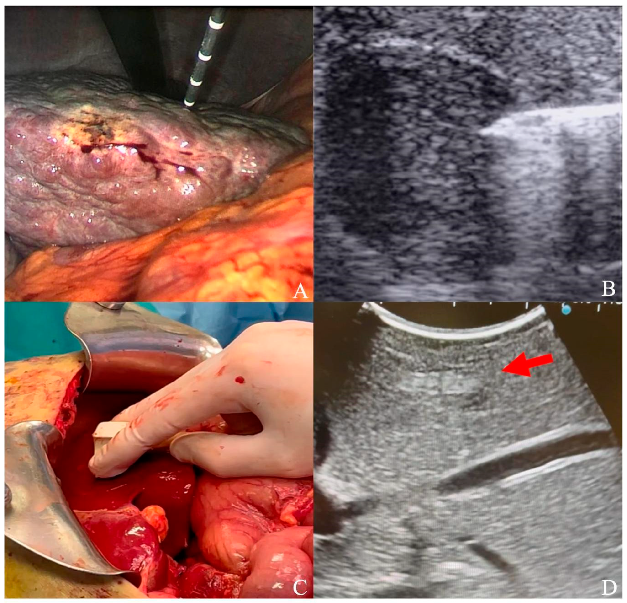 Cancers 16 00092 g001