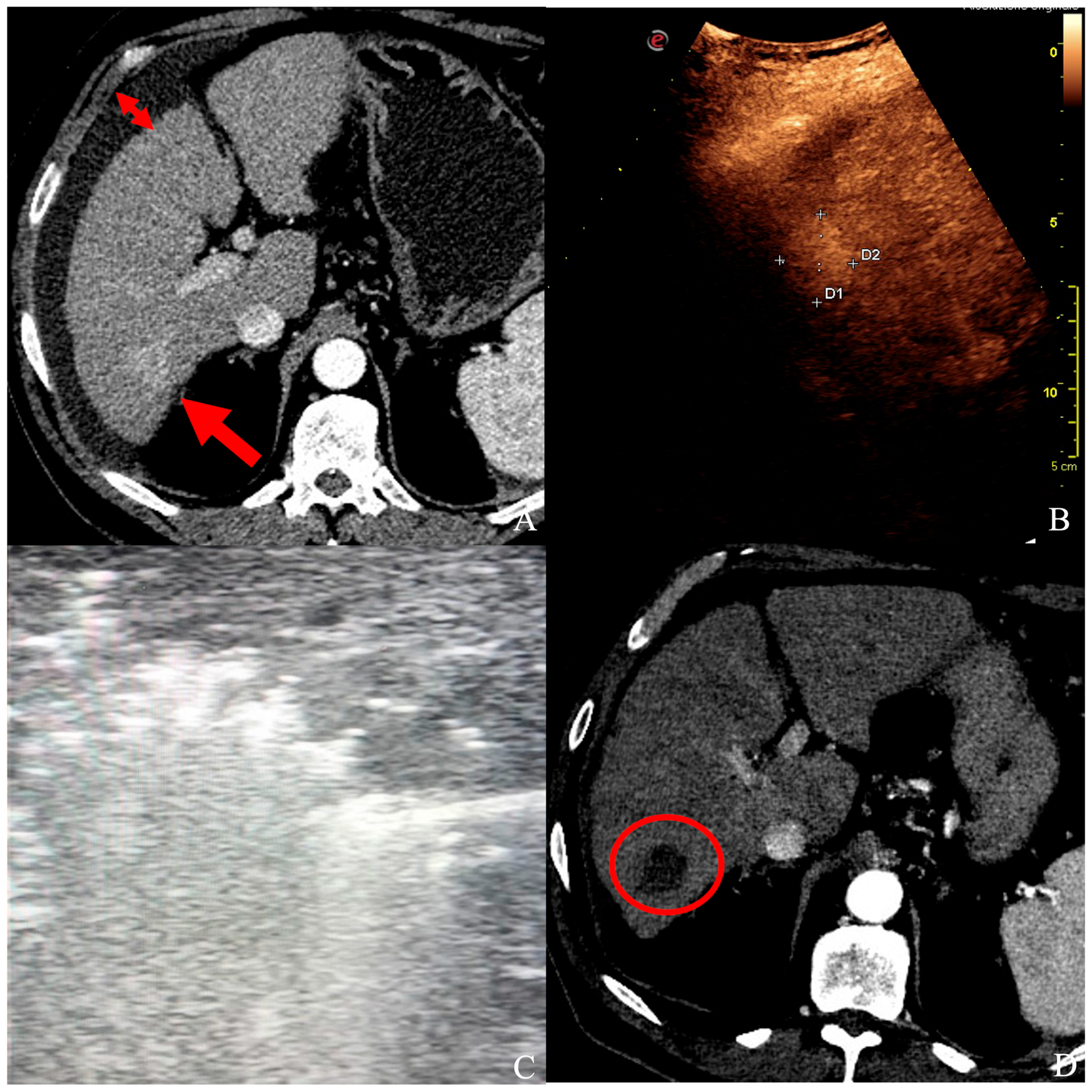 Cancers 16 00092 g002