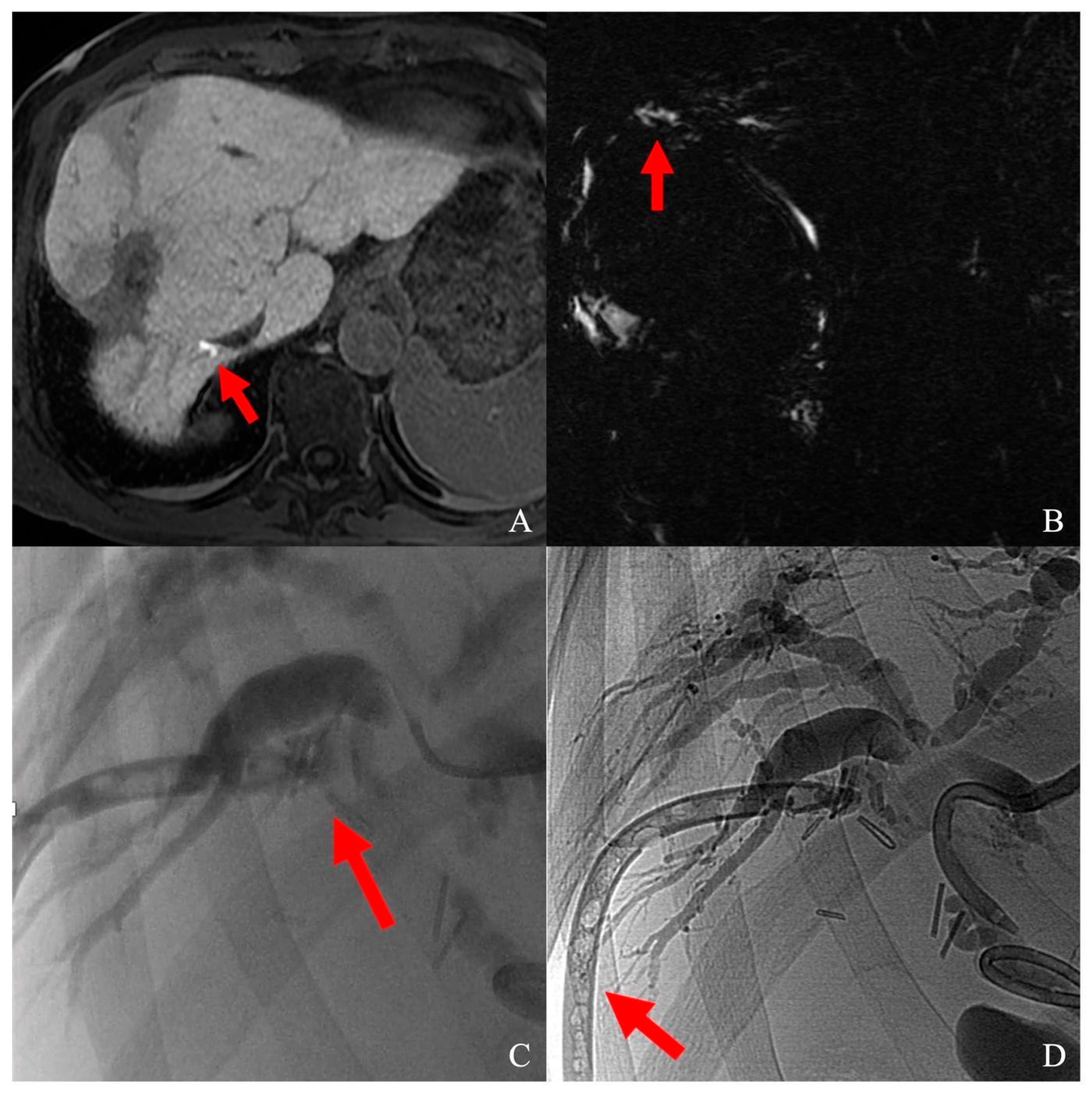 Cancers 16 00092 g003