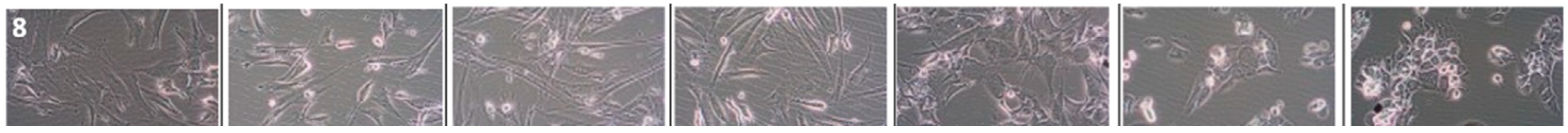 Cancers 16 00120 i006