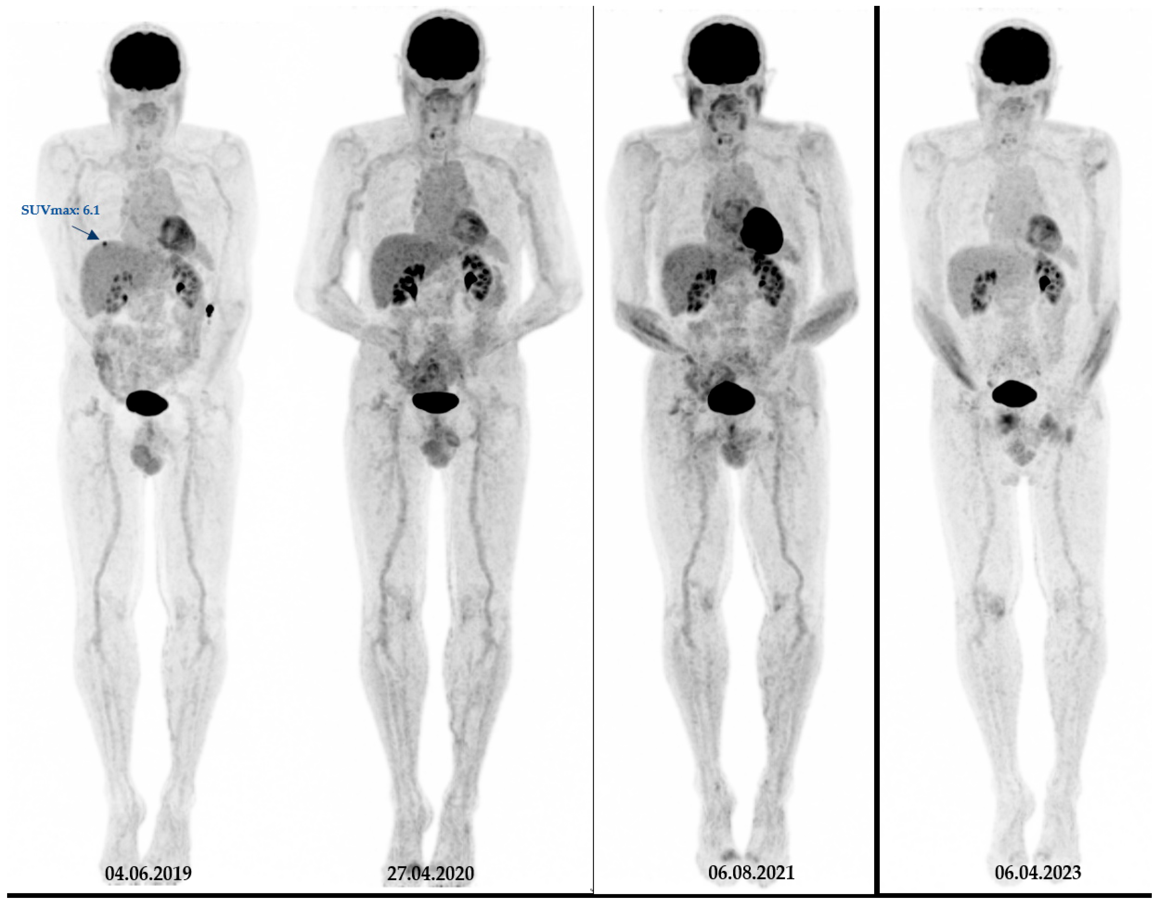 Cancers 16 00127 g003