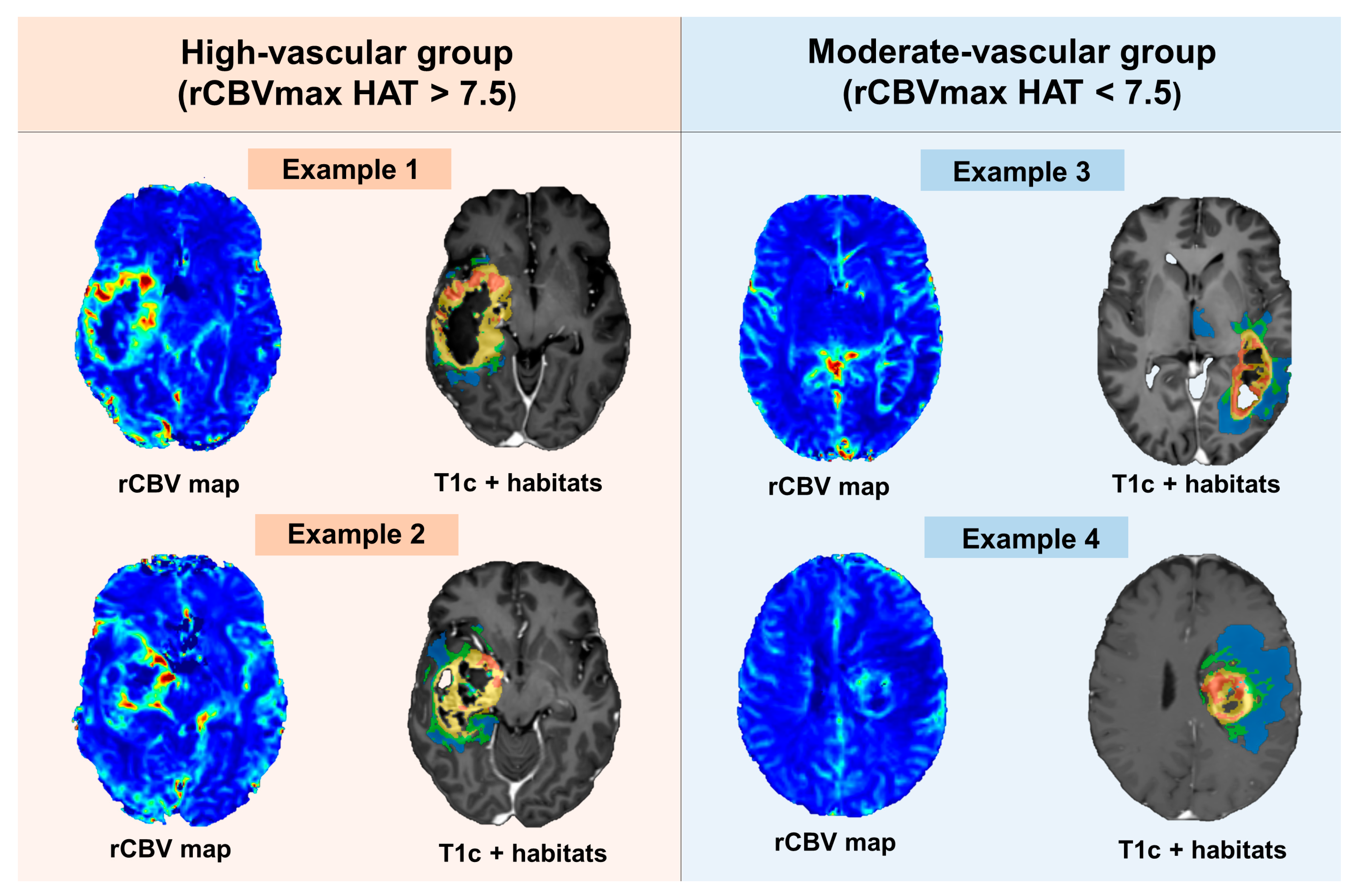 Cancers 16 00161 g003