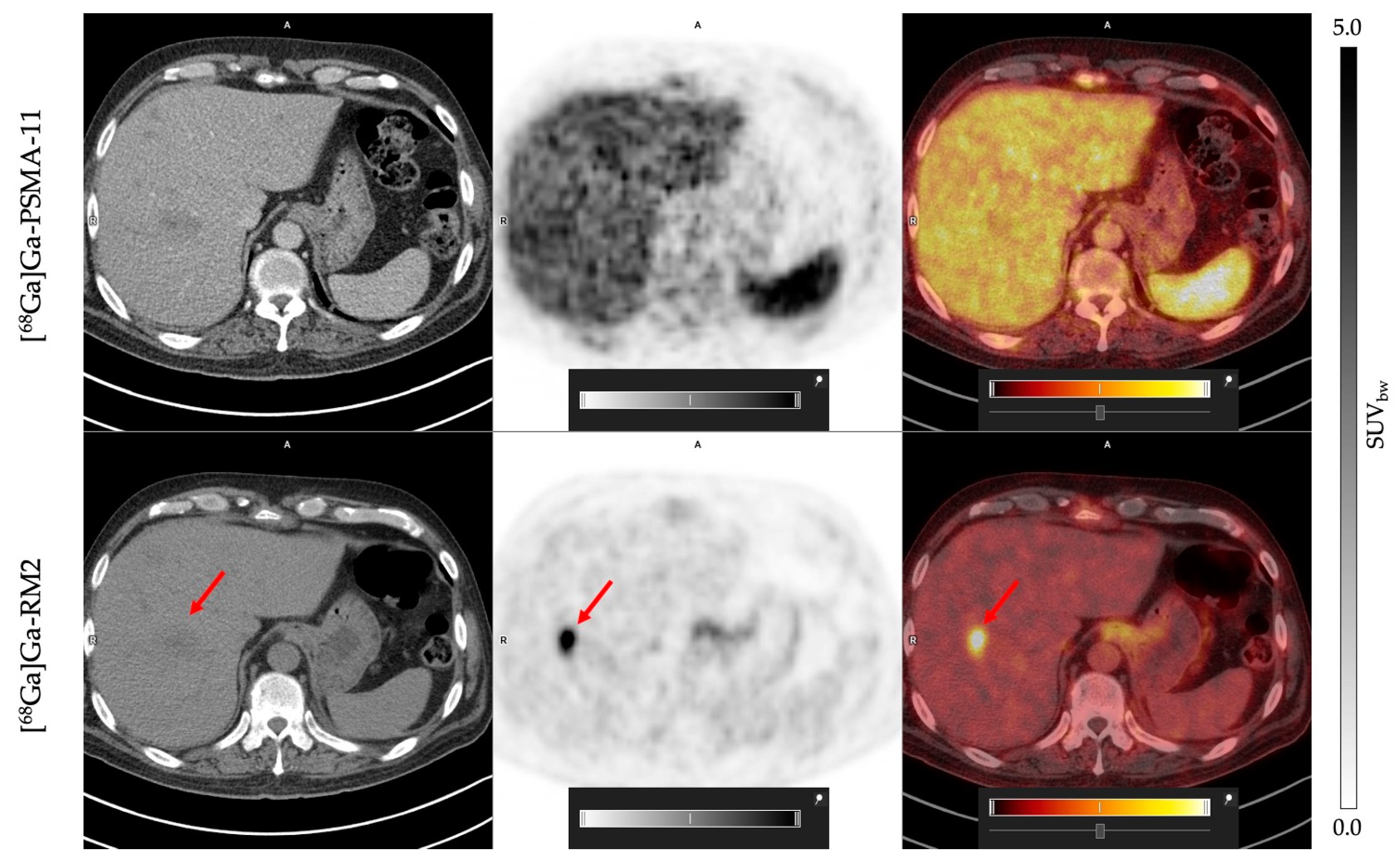 Cancers 16 00173 g003