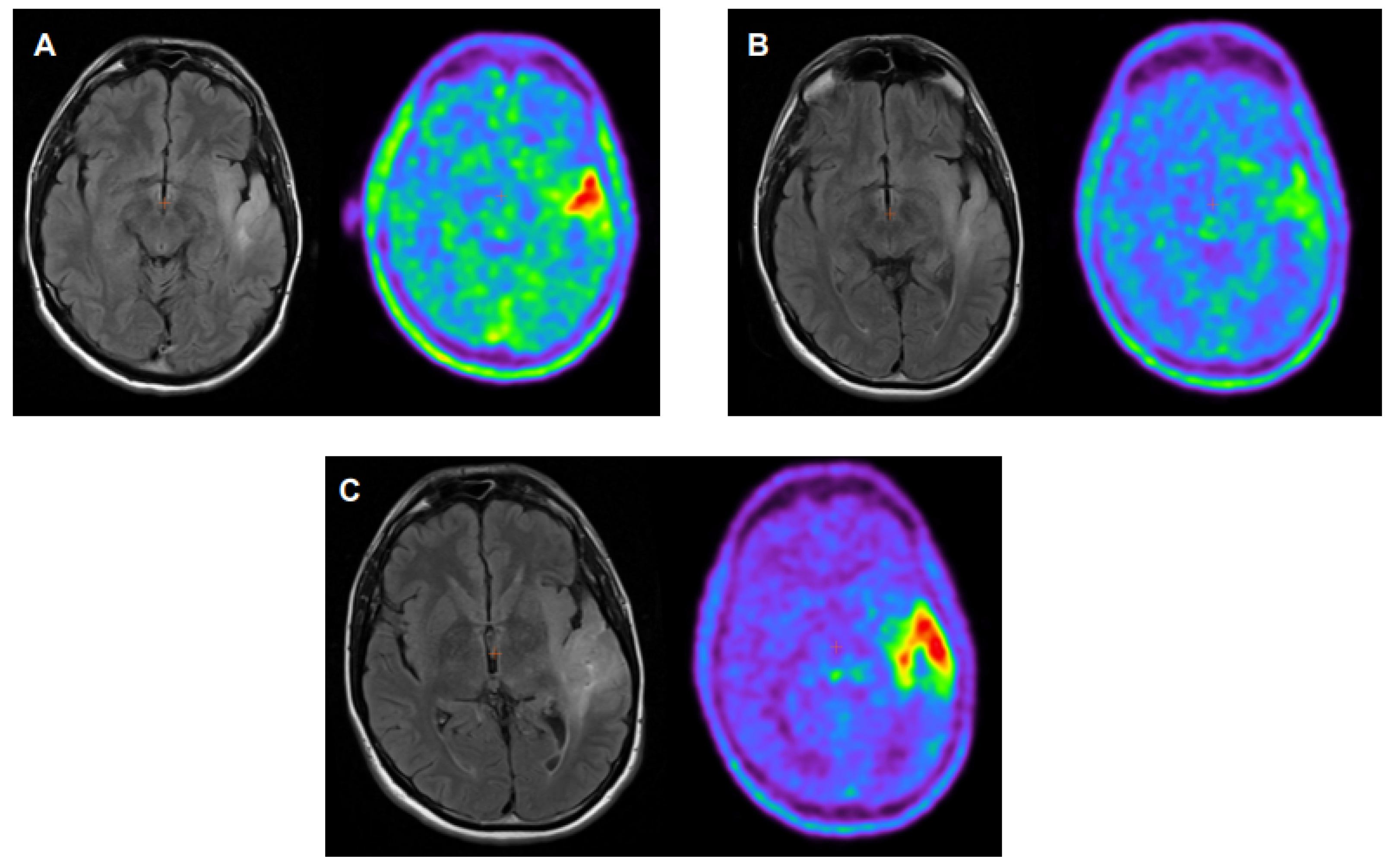 Cancers 16 00195 g002