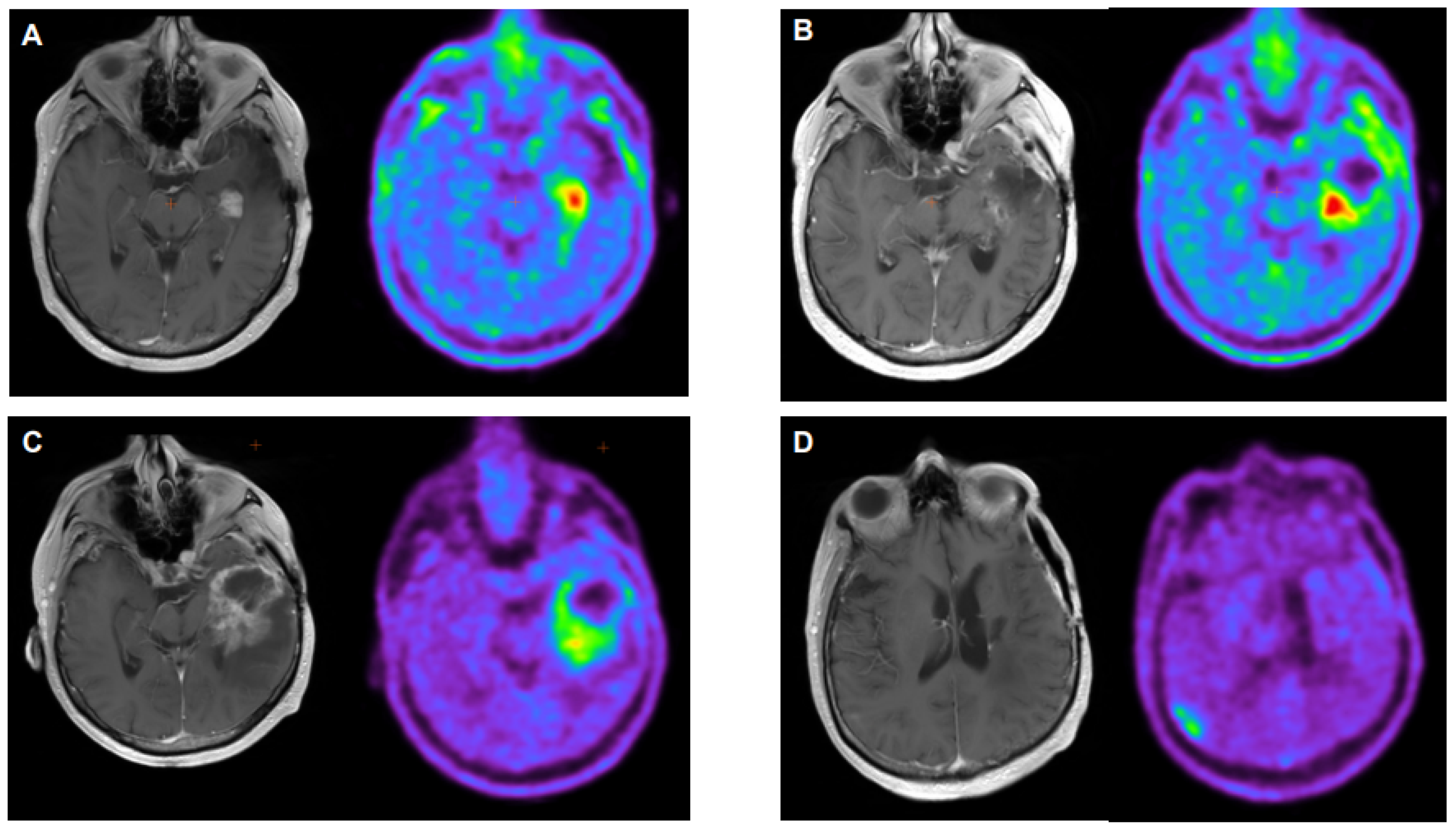 Cancers 16 00195 g003