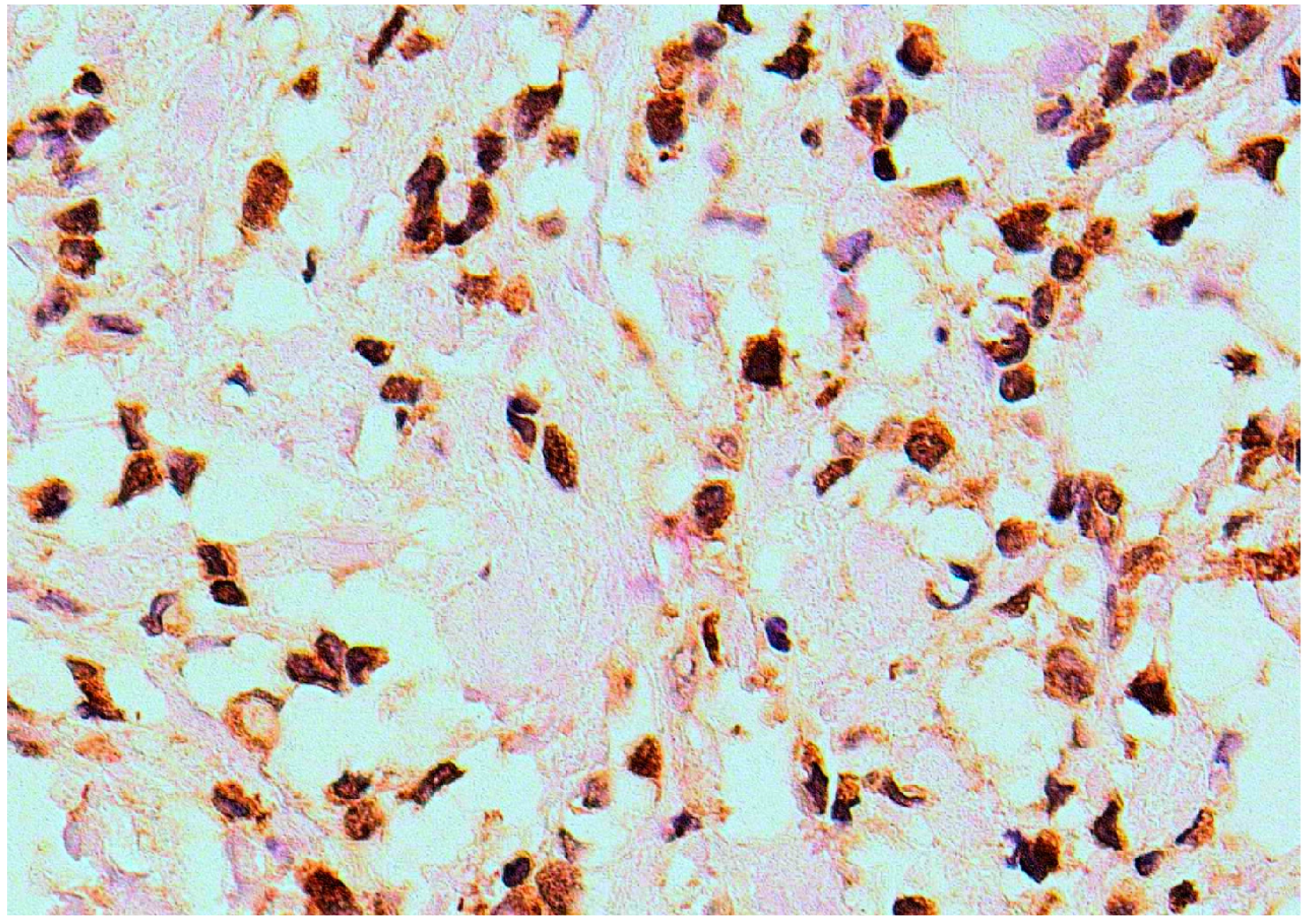 Cancers 16 00209 g002