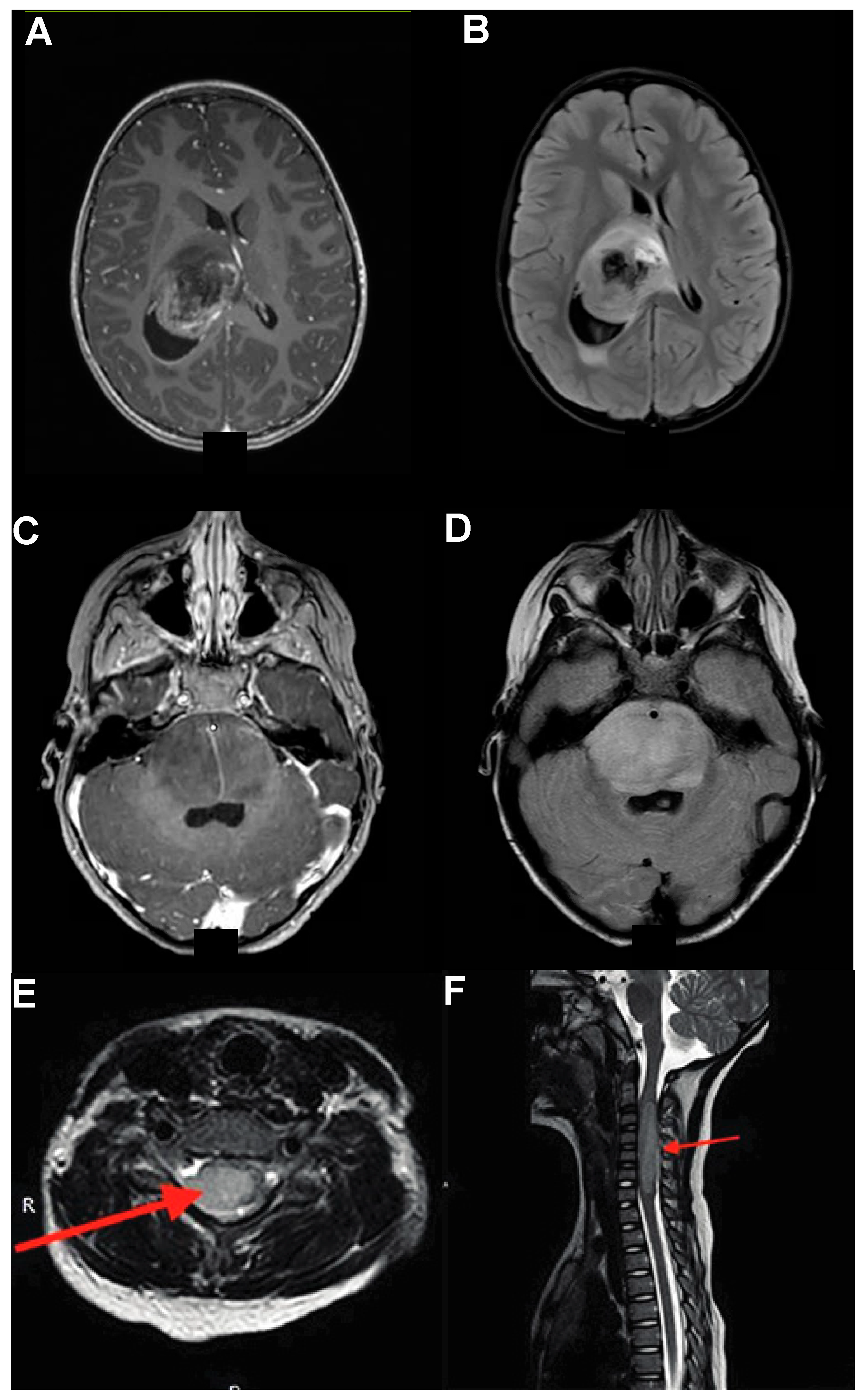 Cancers 16 00219 g002