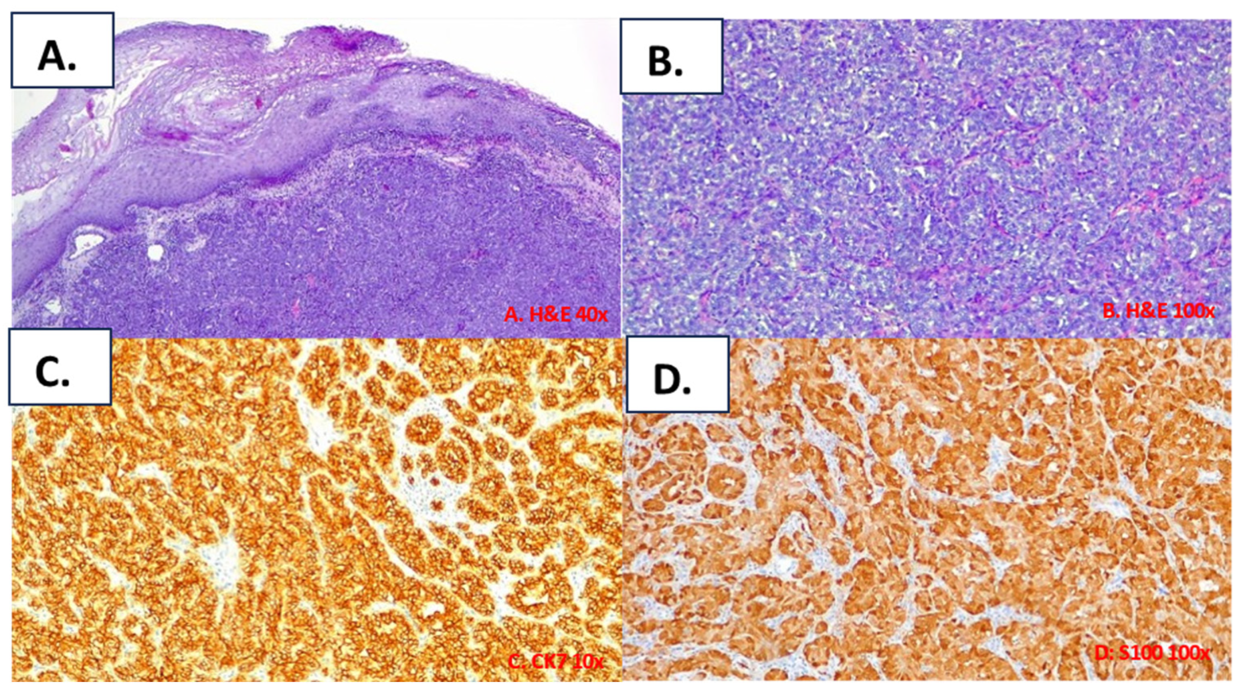 Cancers 16 00220 g003 Cancers 16 00220 g003