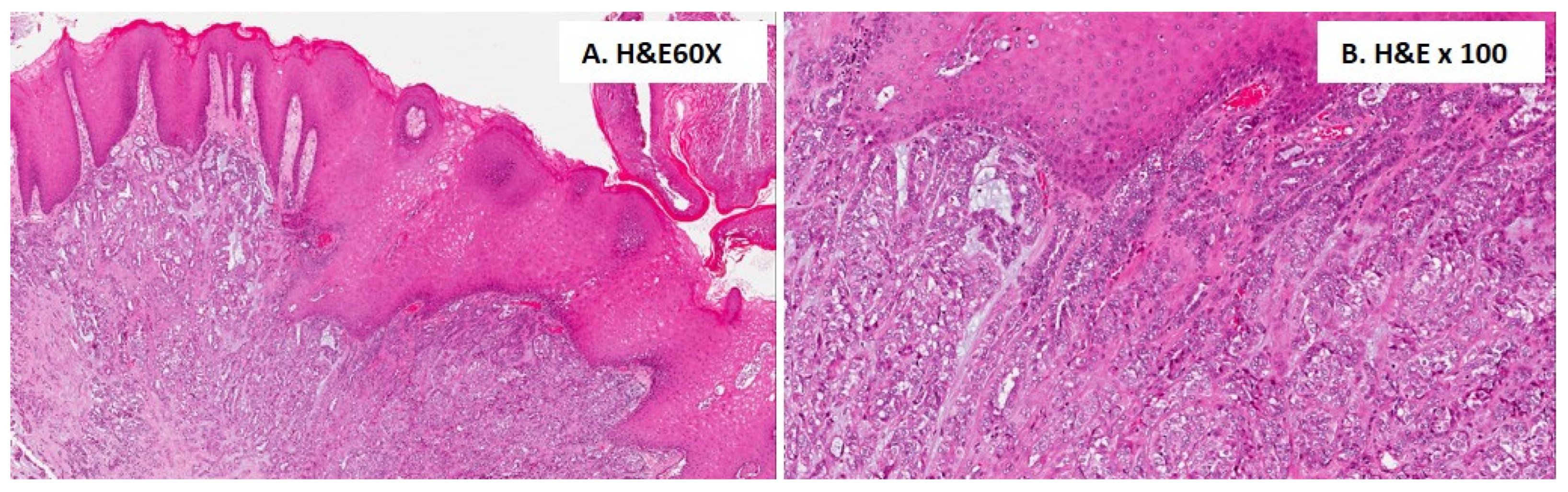 Cancers 16 00220 g004 Cancers 16 00220 g004