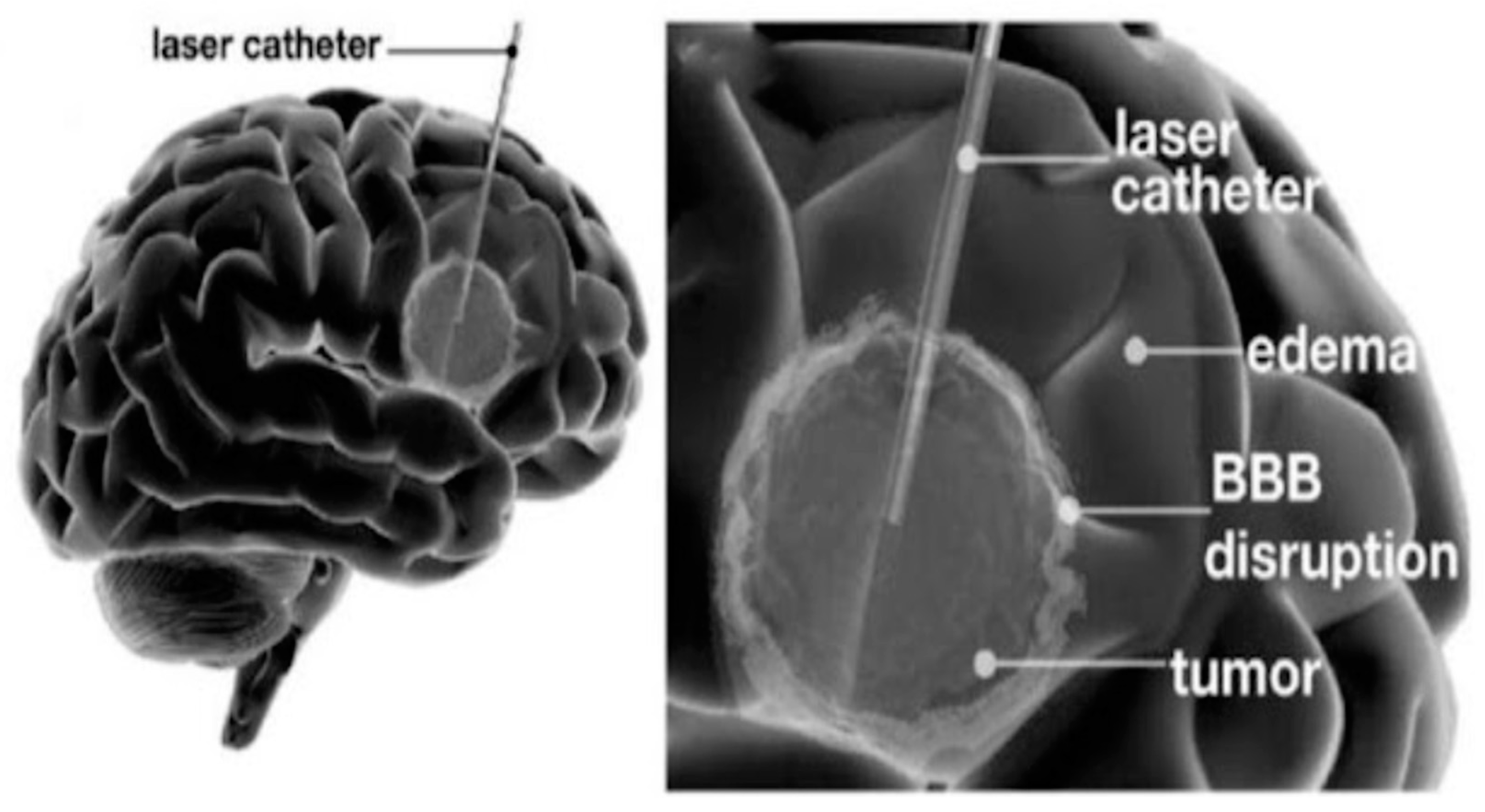 Cancers 16 00236 g007