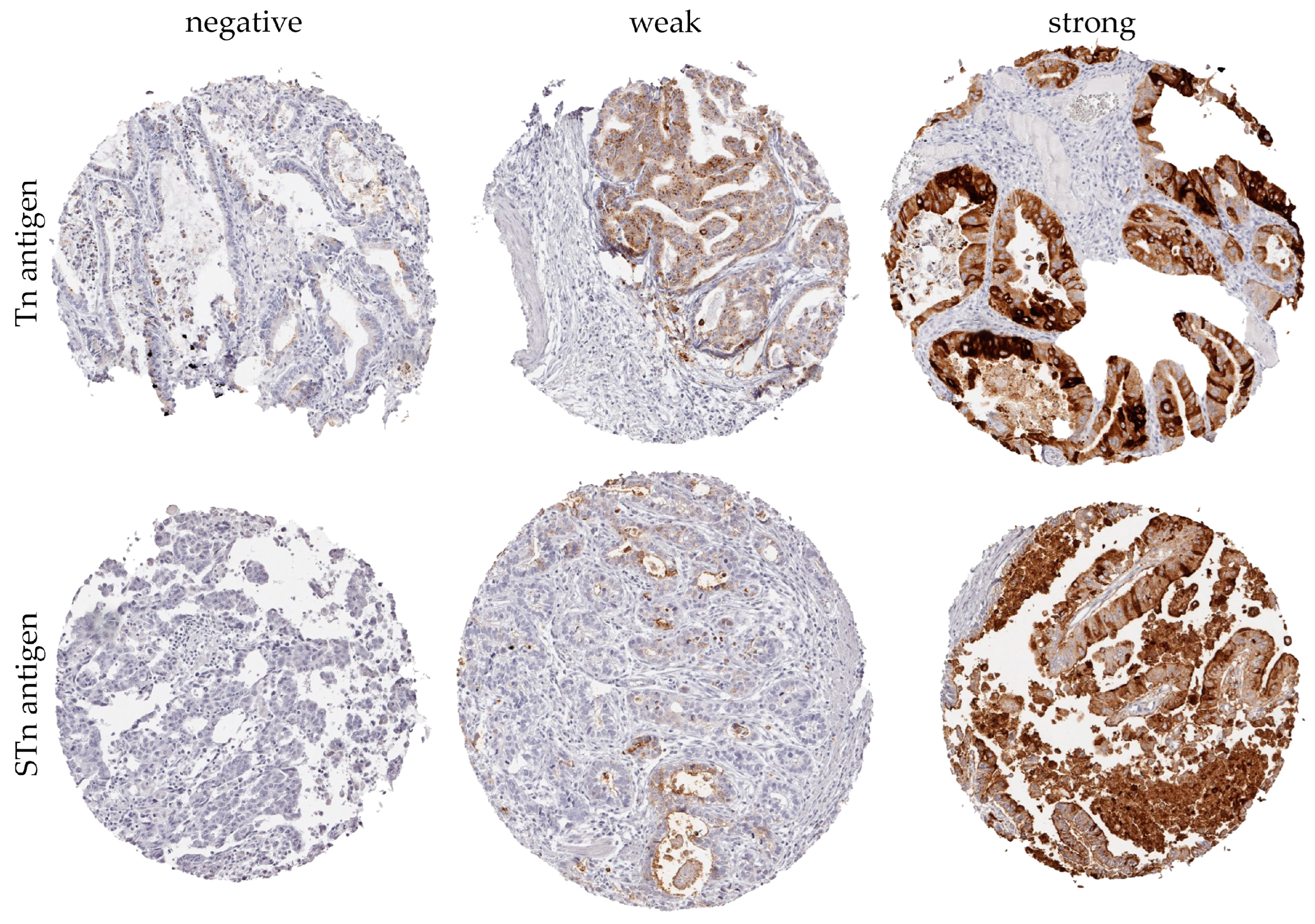 Cancers 16 00240 g002