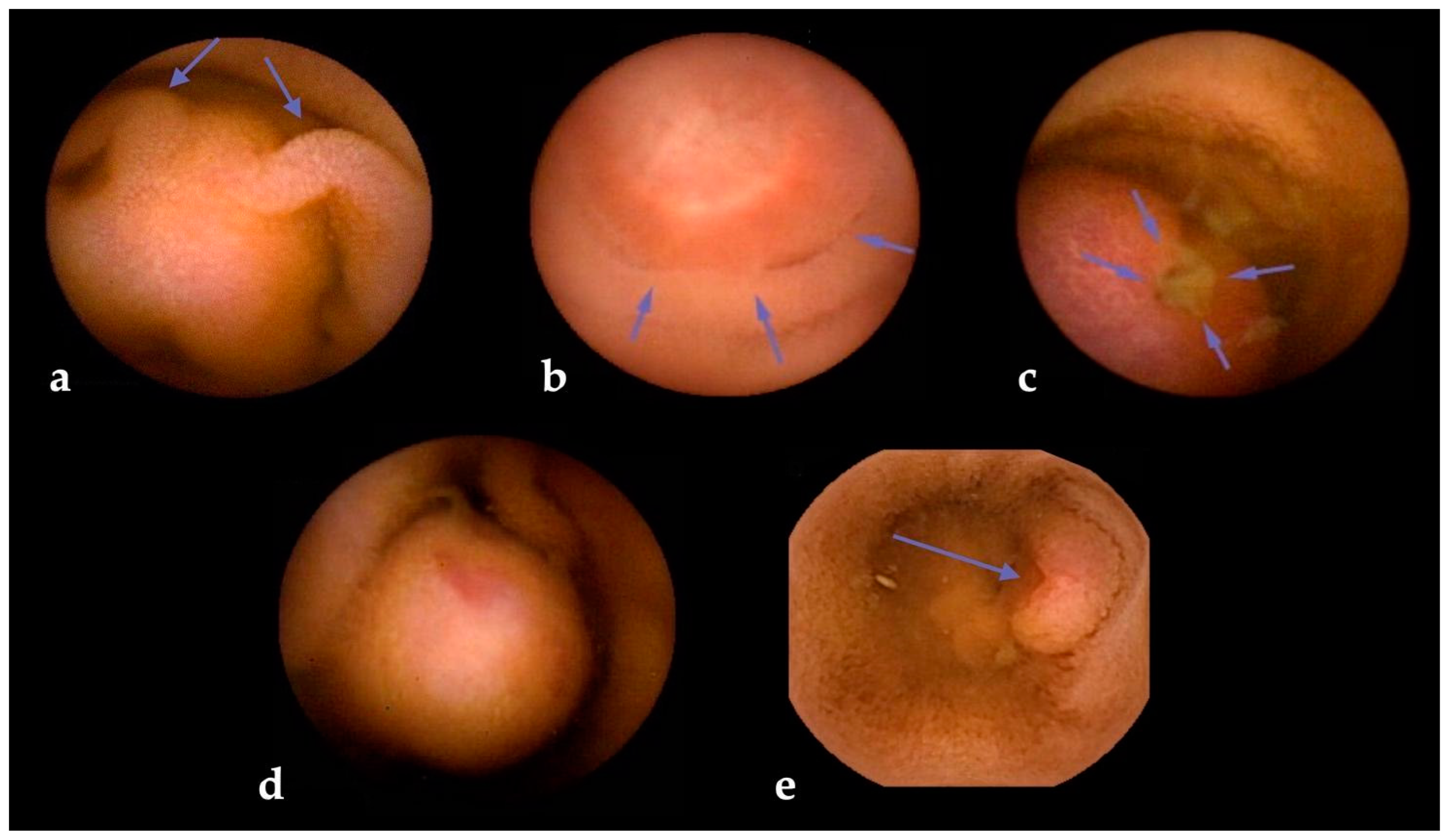 Cancers 16 00262 g003