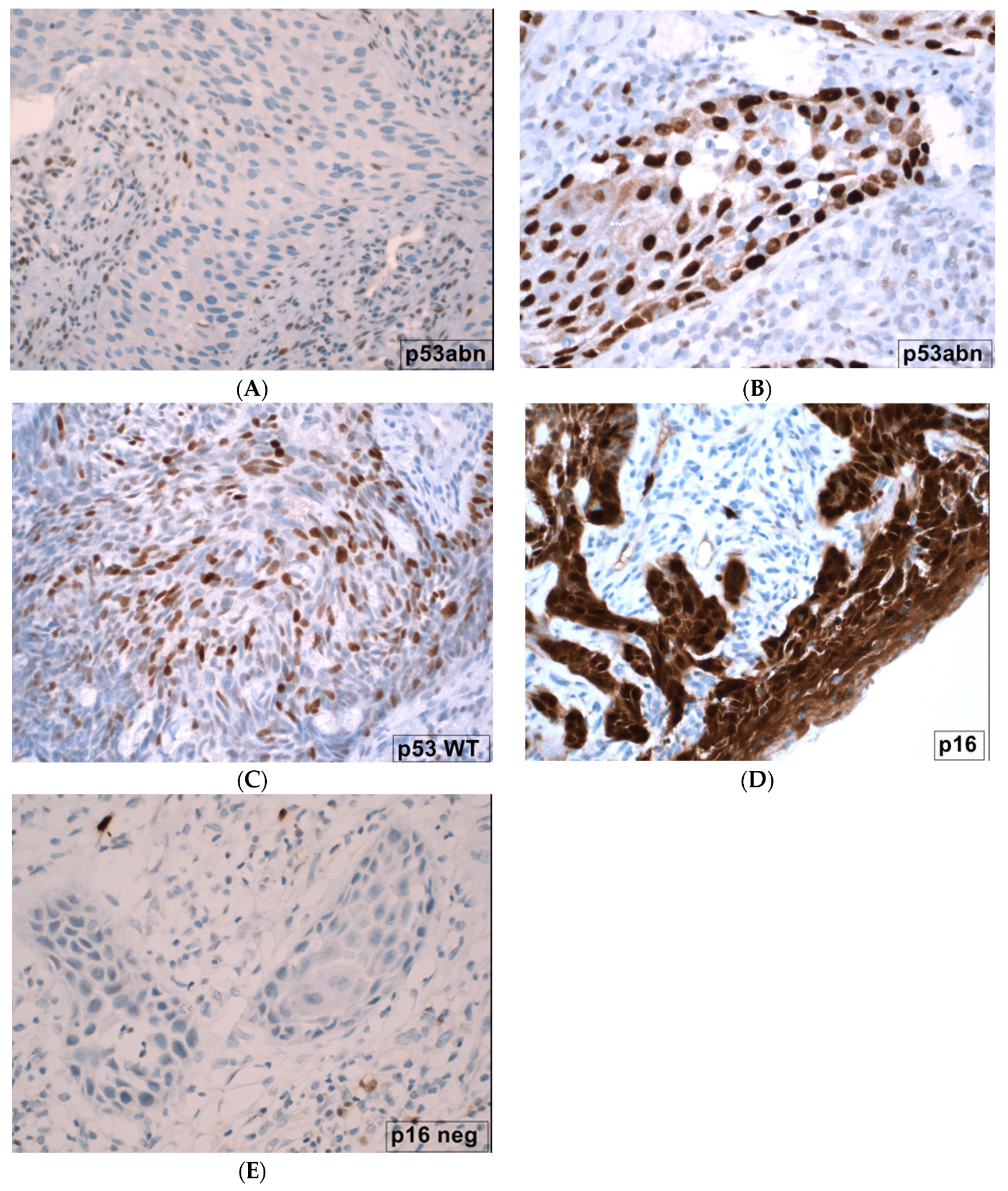 Cancers 16 00276 g002