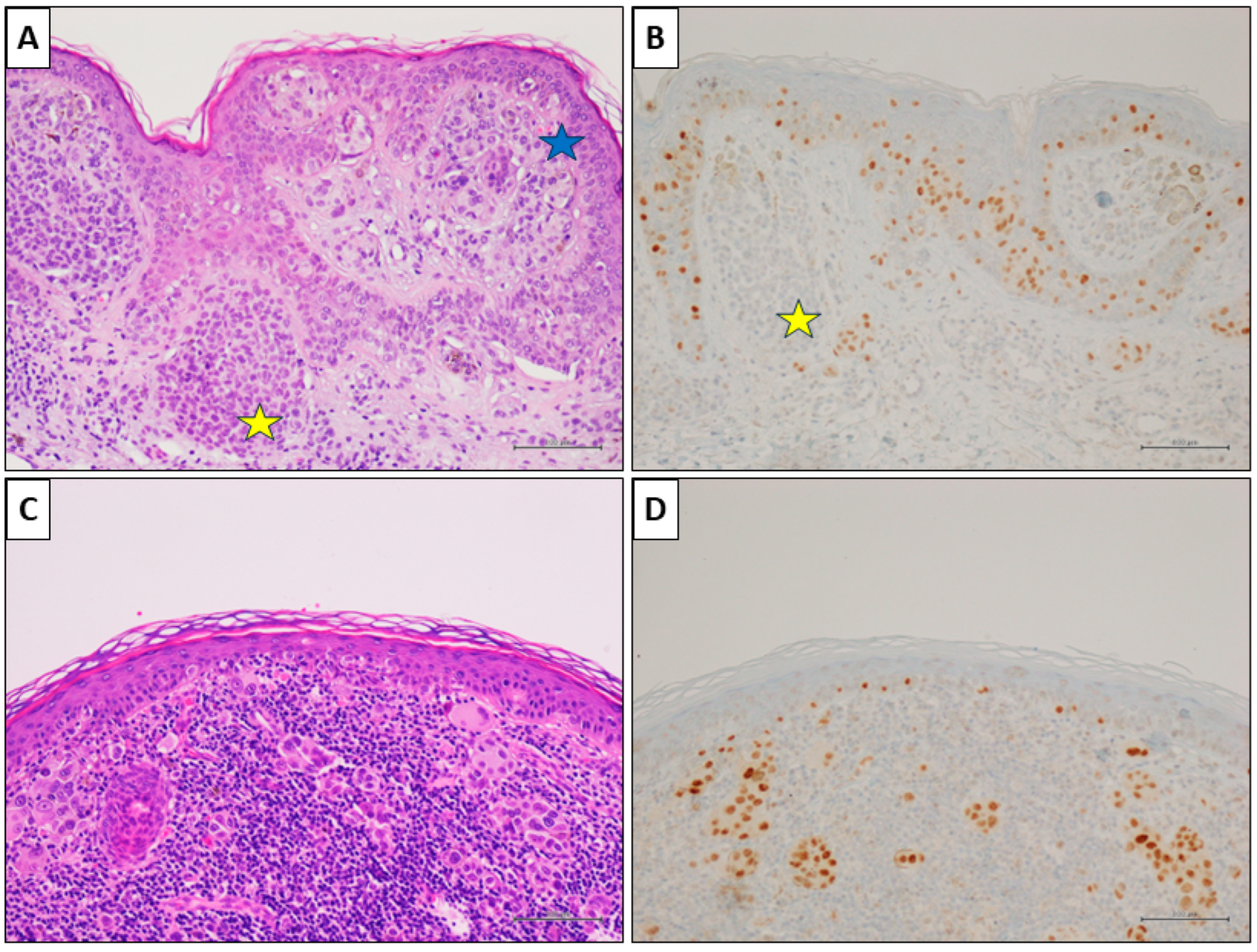 Cancers 16 00278 g003 Cancers 16 00278 g003