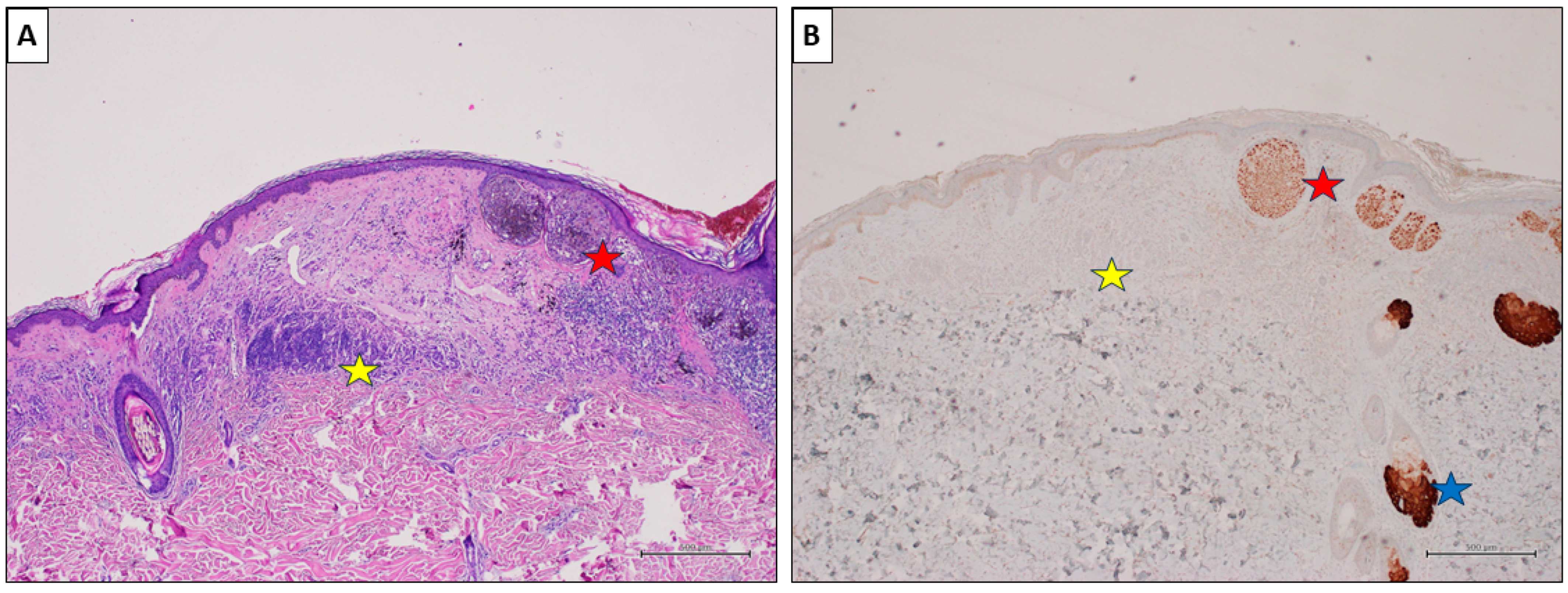 Cancers 16 00278 g005 Cancers 16 00278 g005