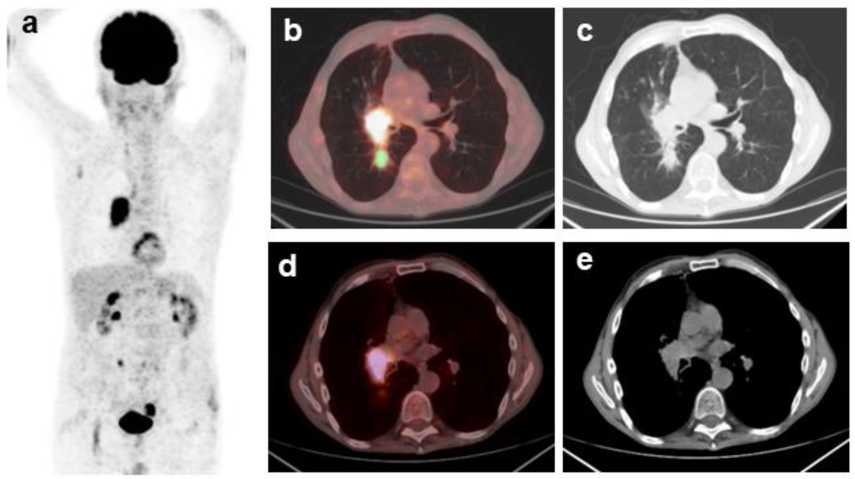 Cancers 16 00279 g001