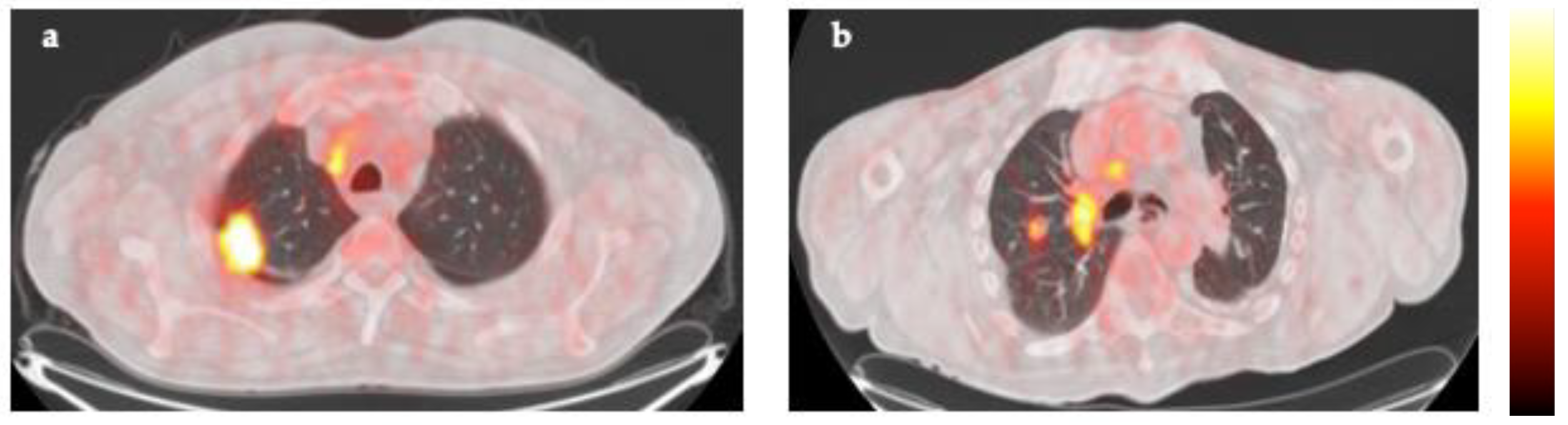 Cancers 16 00279 g004