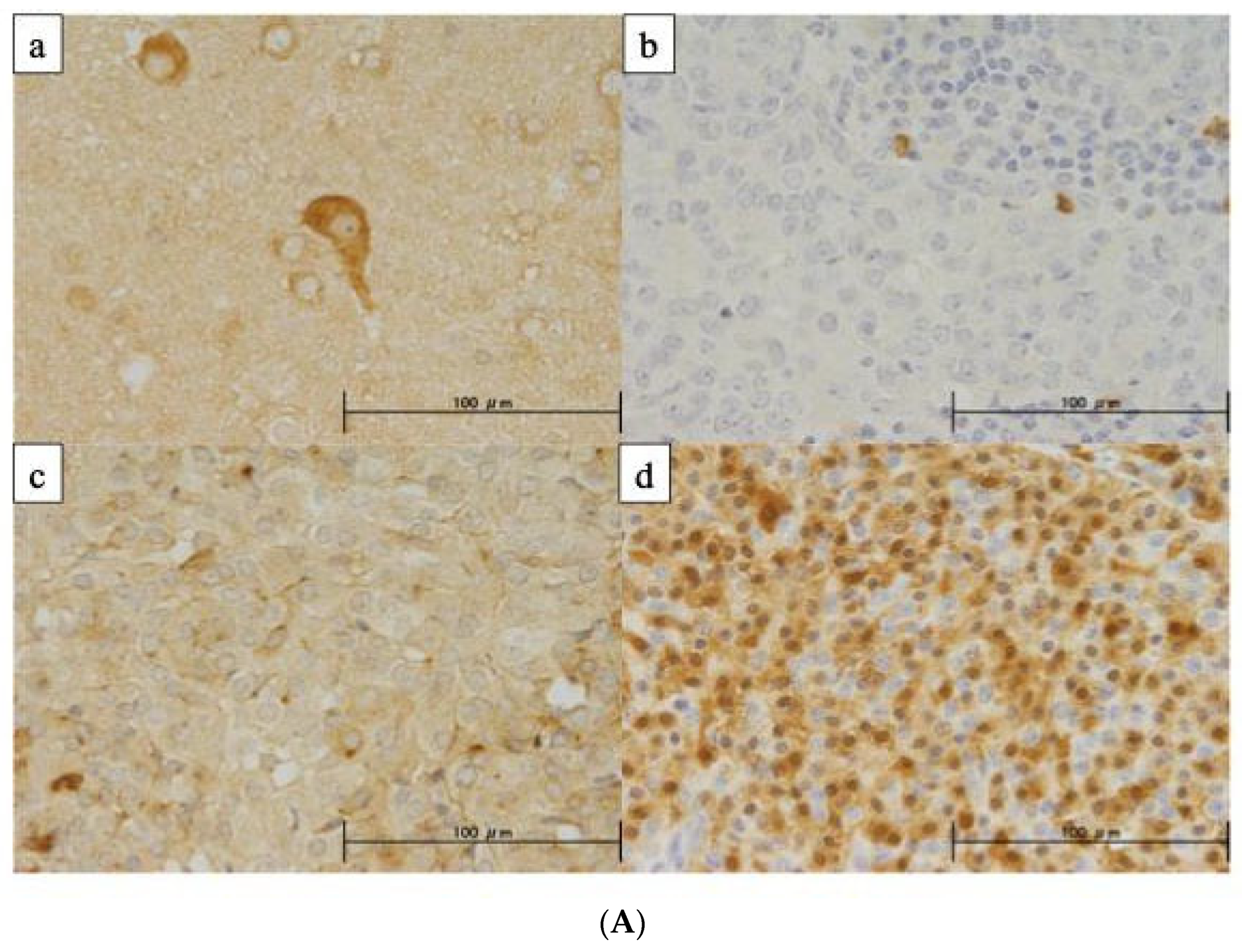 Cancers 16 00329 g005a Cancers 16 00329 g005a