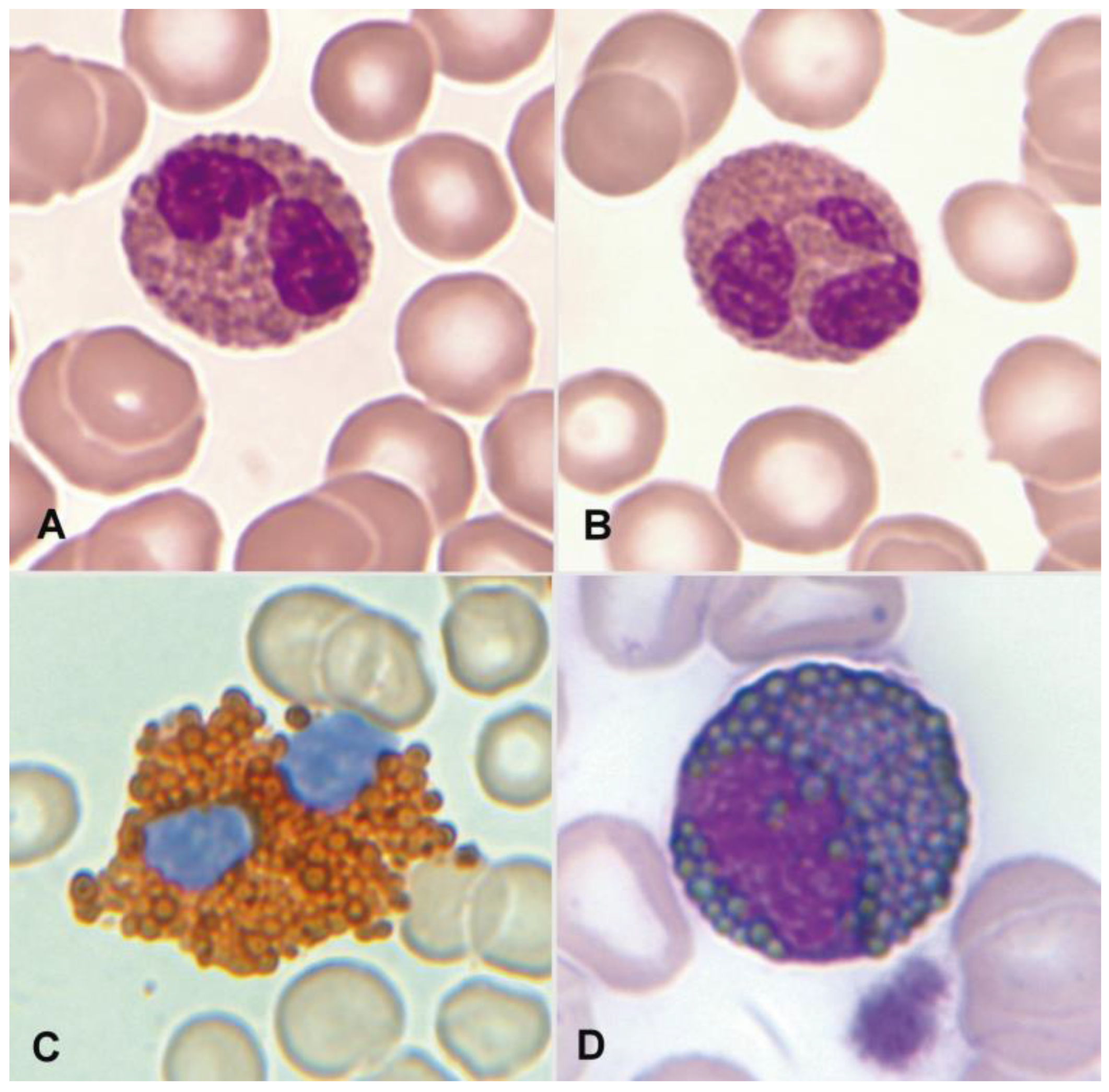 Cancers 16 00337 g001