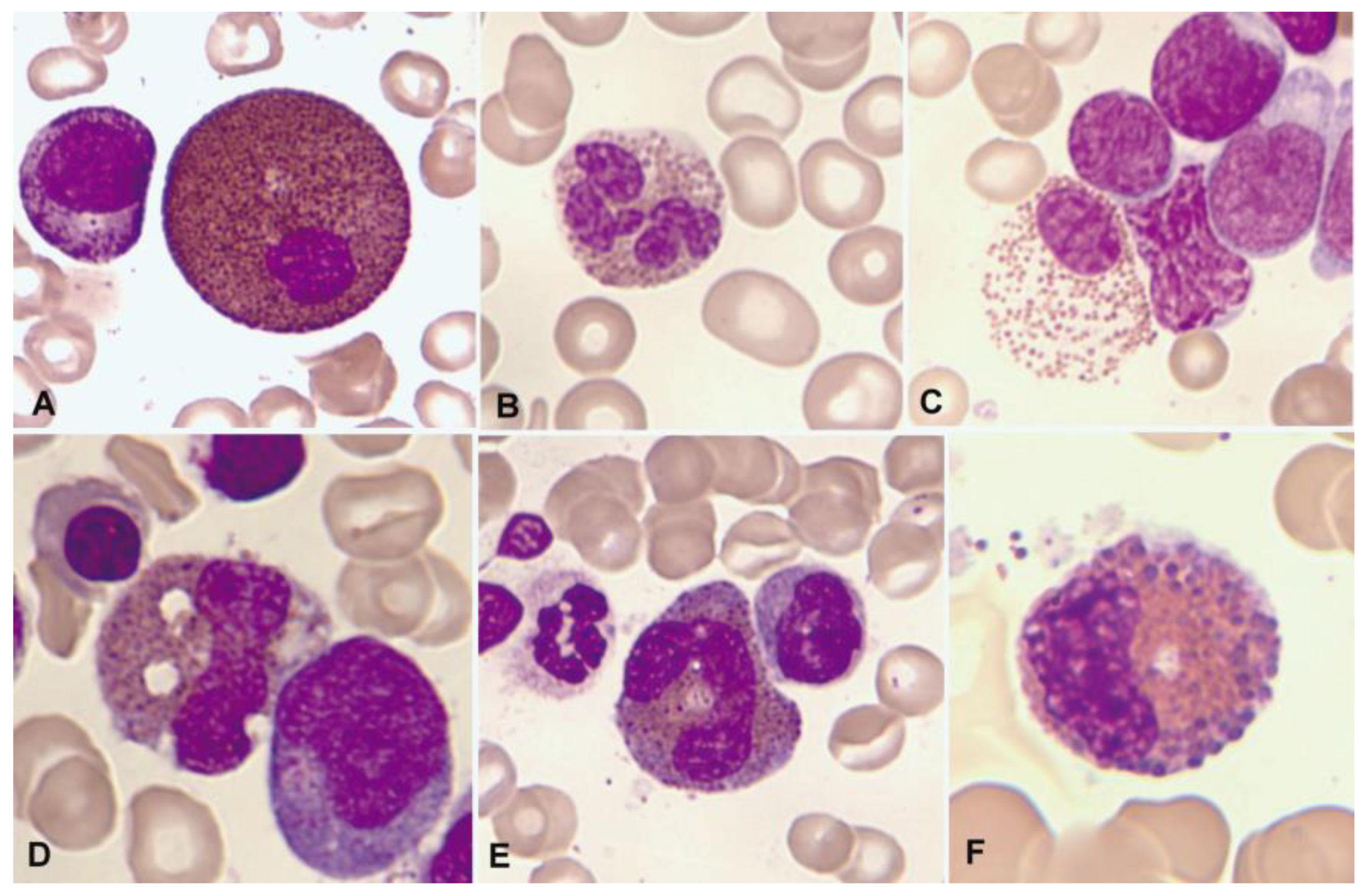 Cancers 16 00337 g002