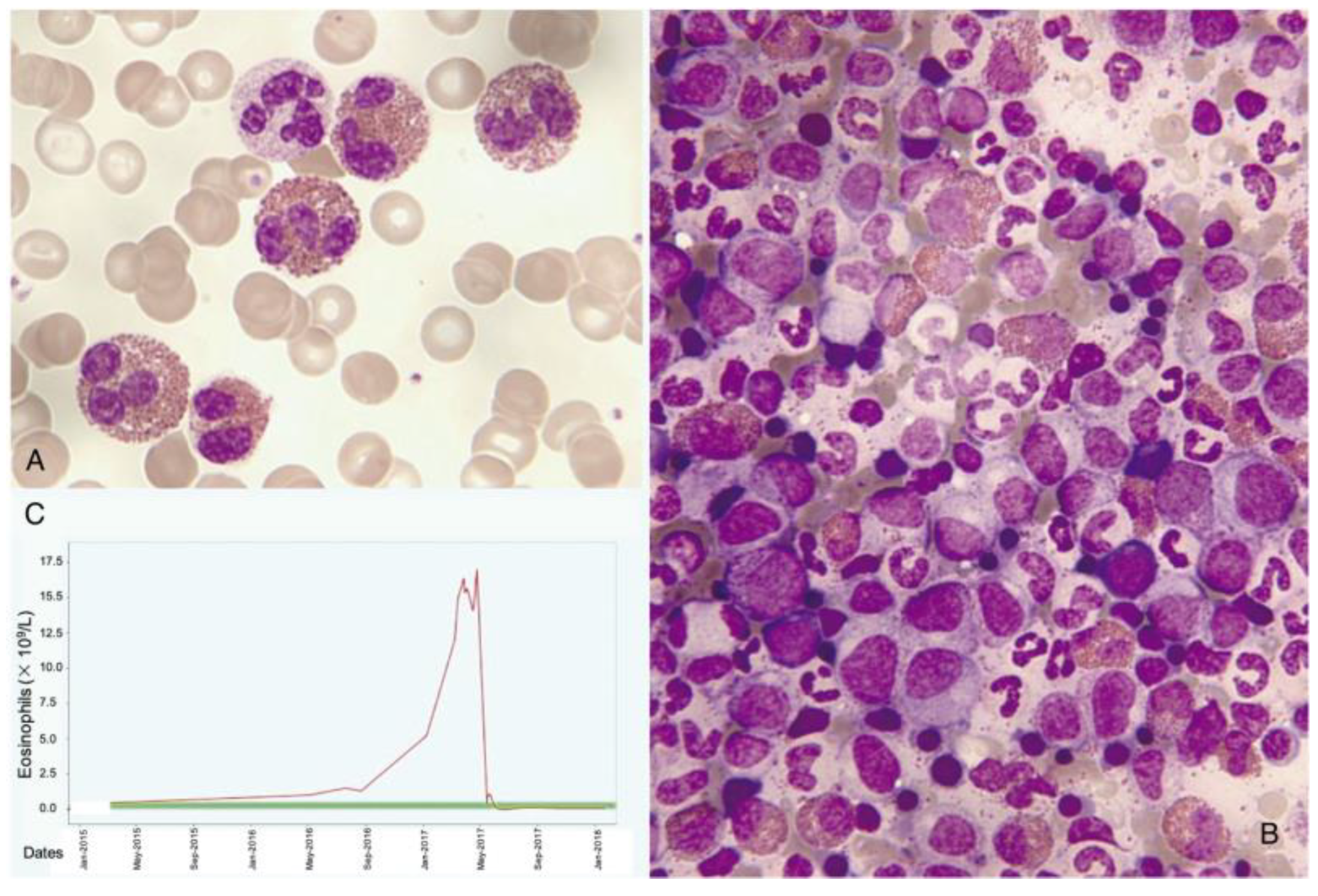 Cancers 16 00337 g004