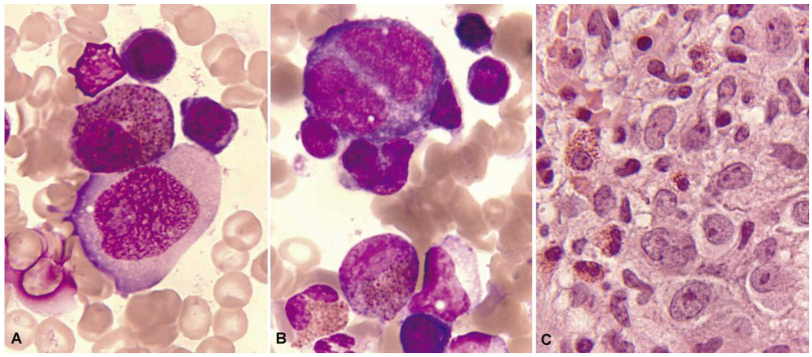 Cancers 16 00337 g005