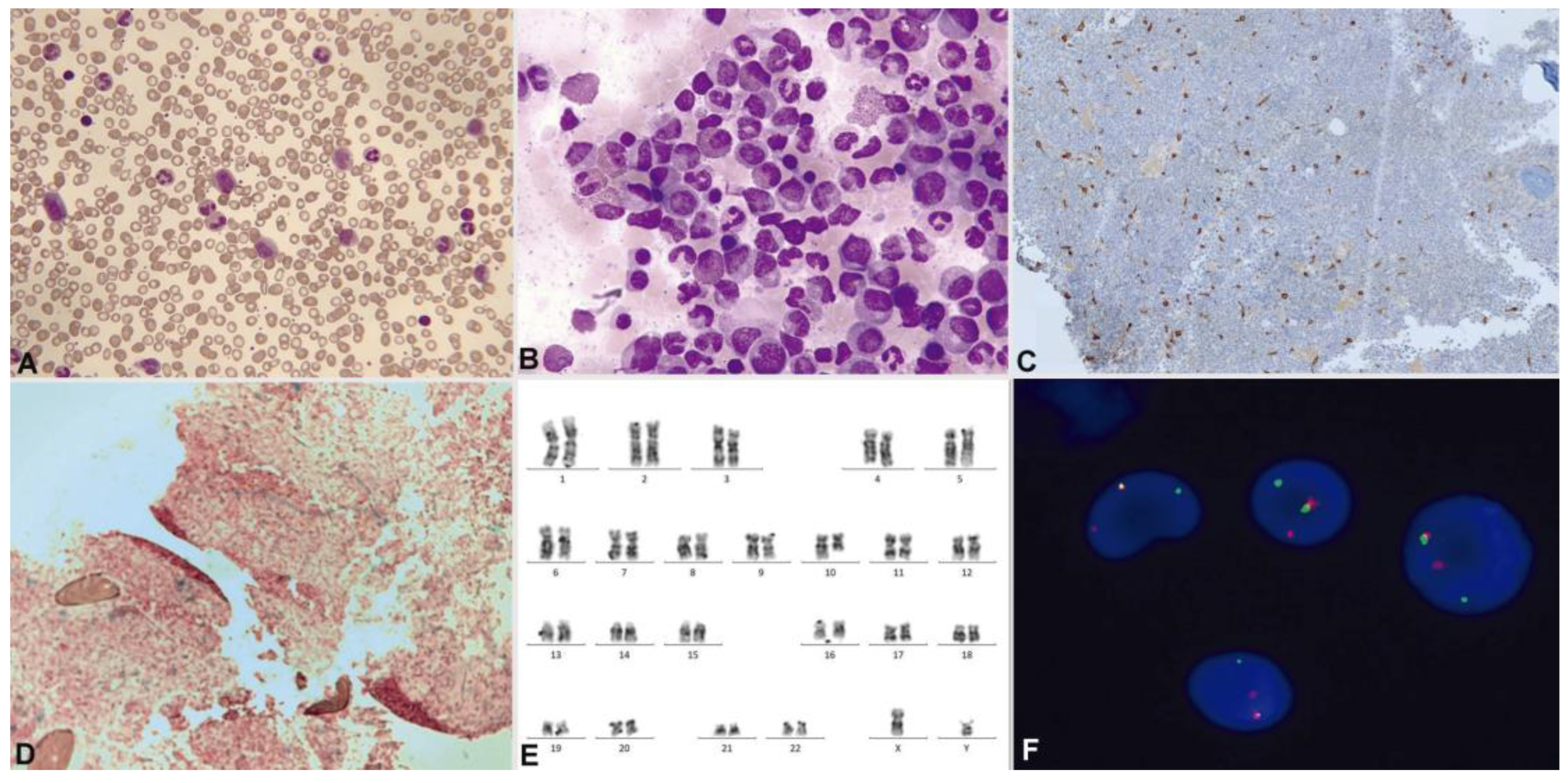 Cancers 16 00337 g009