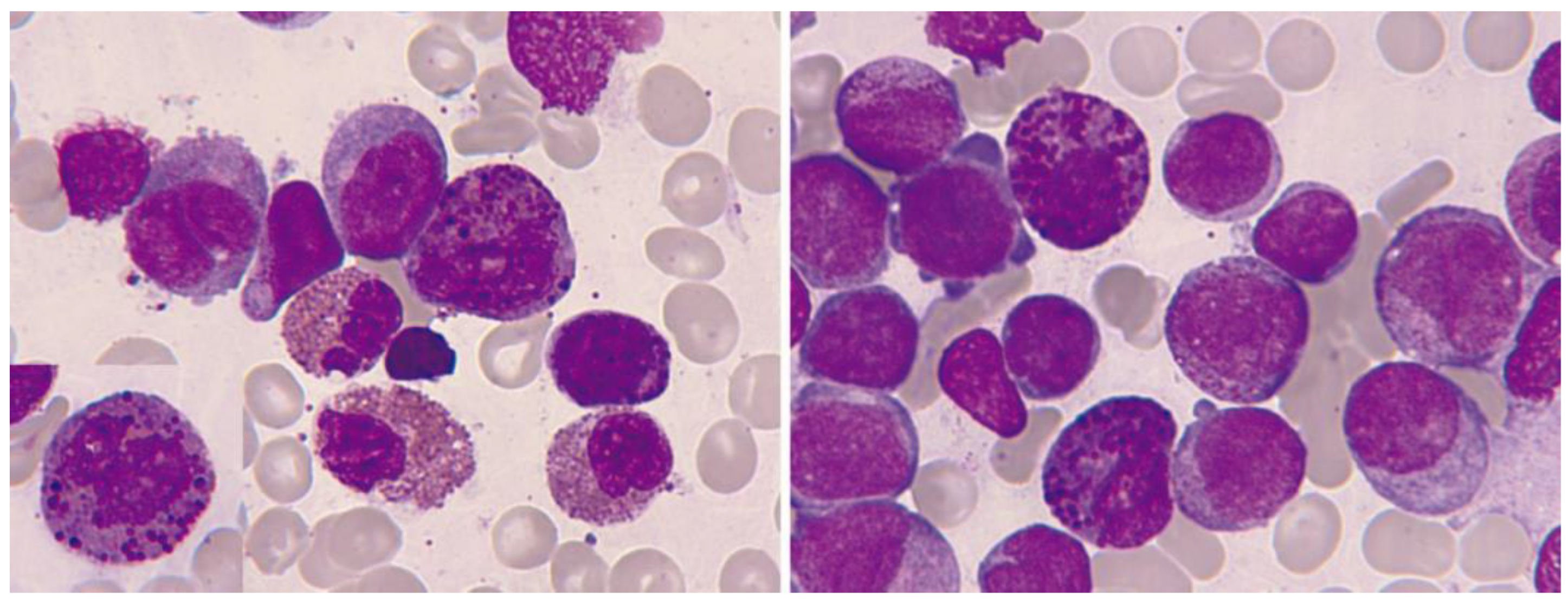 Cancers 16 00337 g010