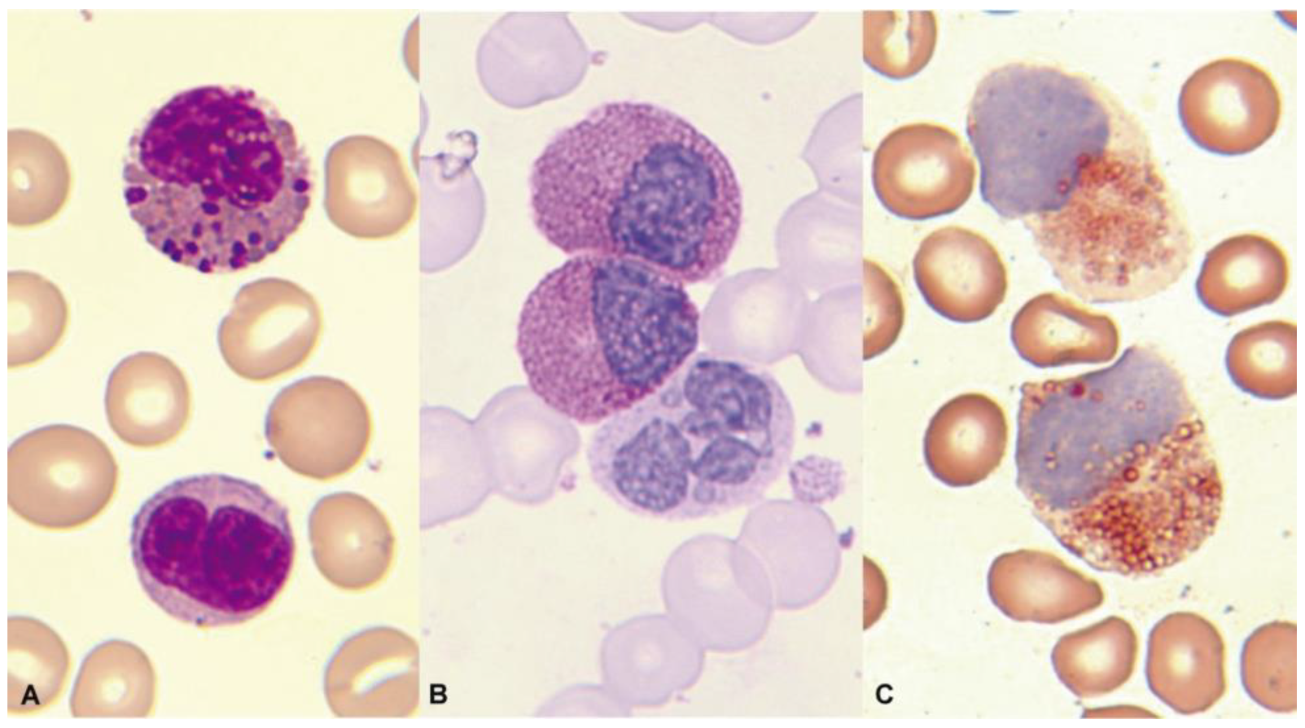 Cancers 16 00337 g012