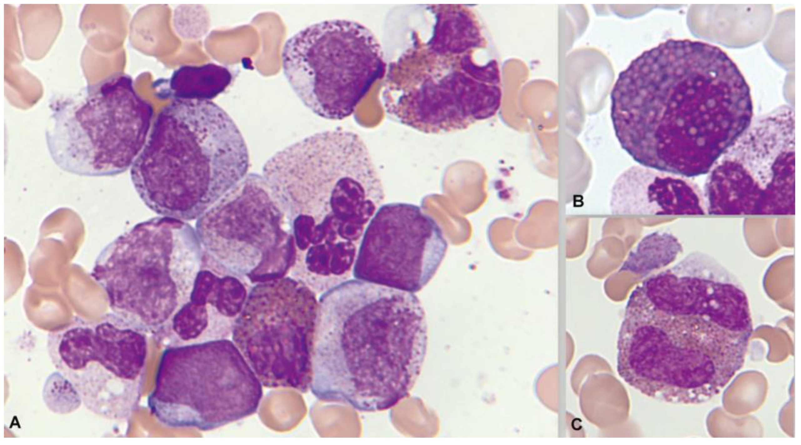 Cancers 16 00337 g013