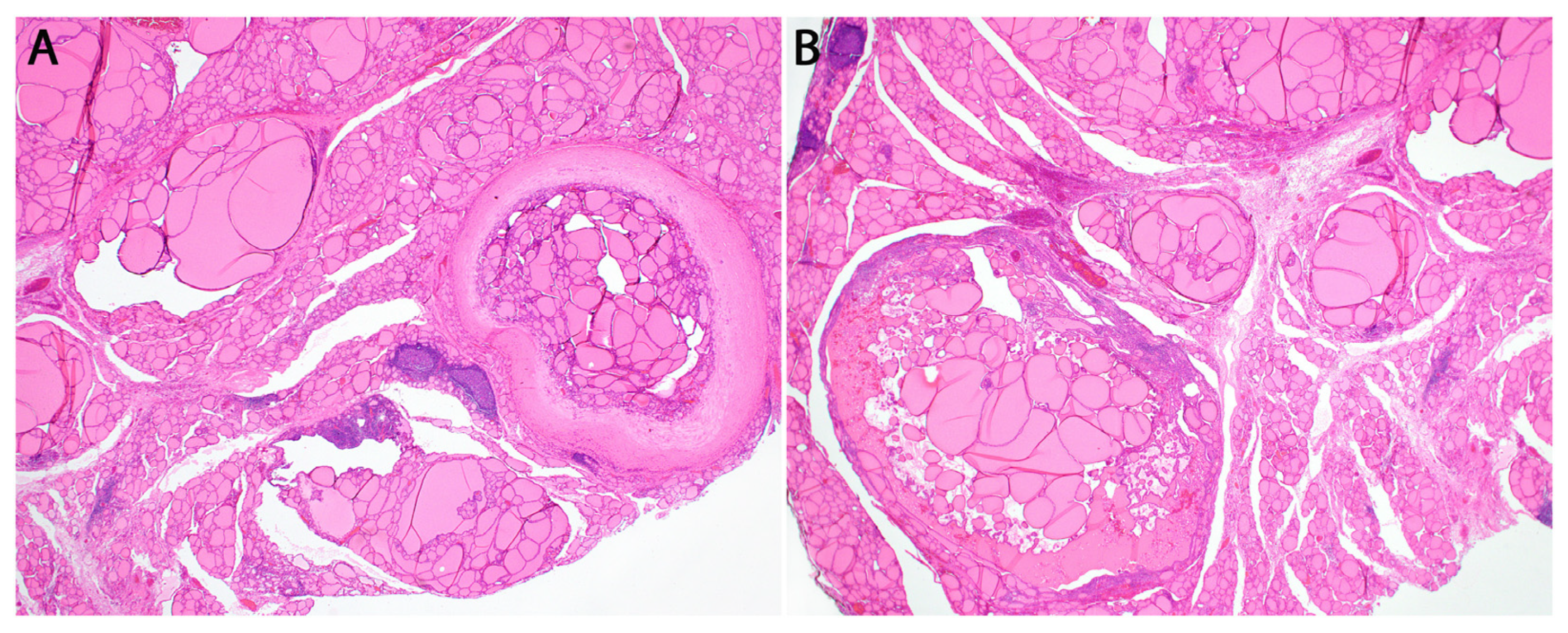Cancers 16 00347 g006