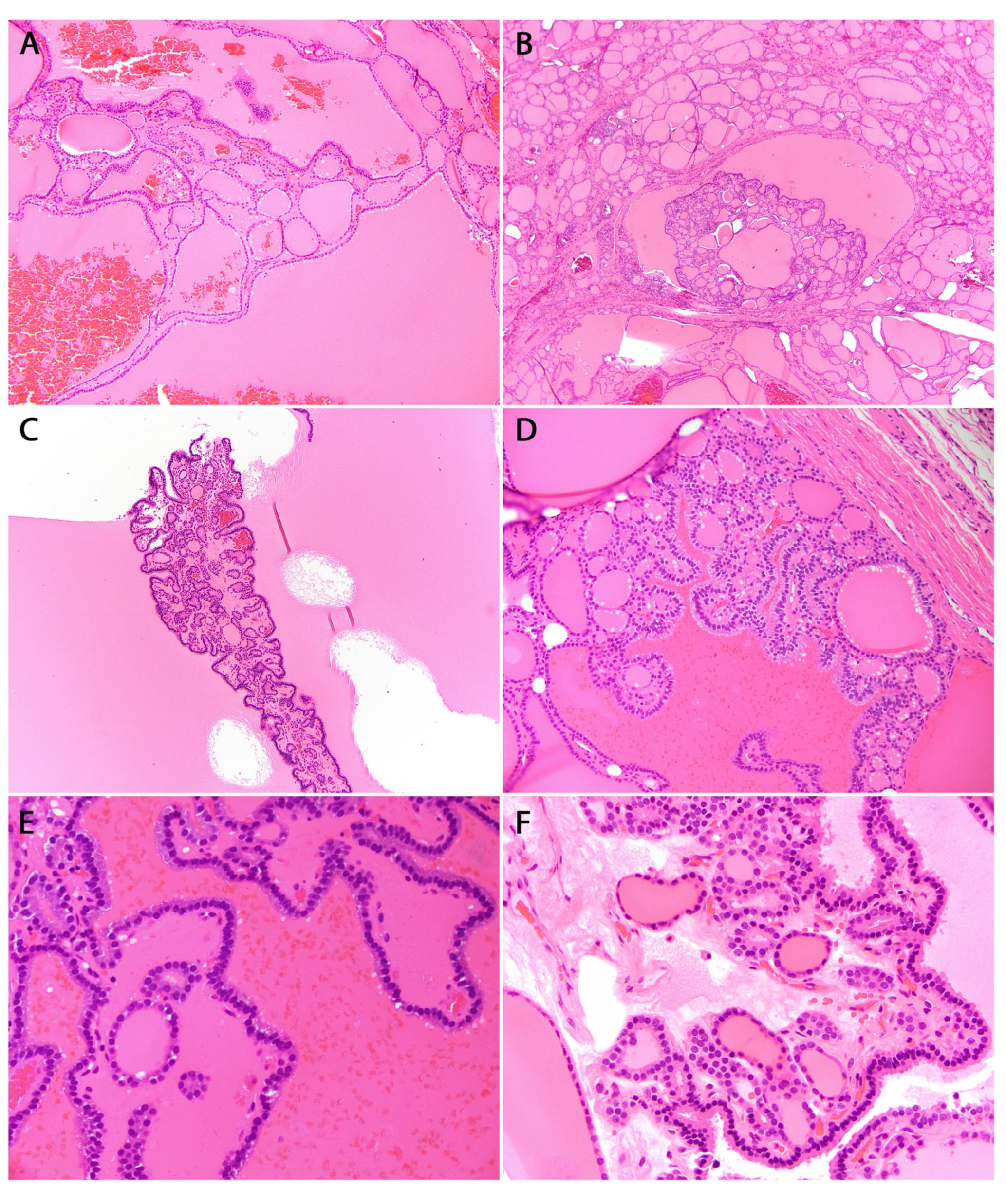 Cancers 16 00347 g007