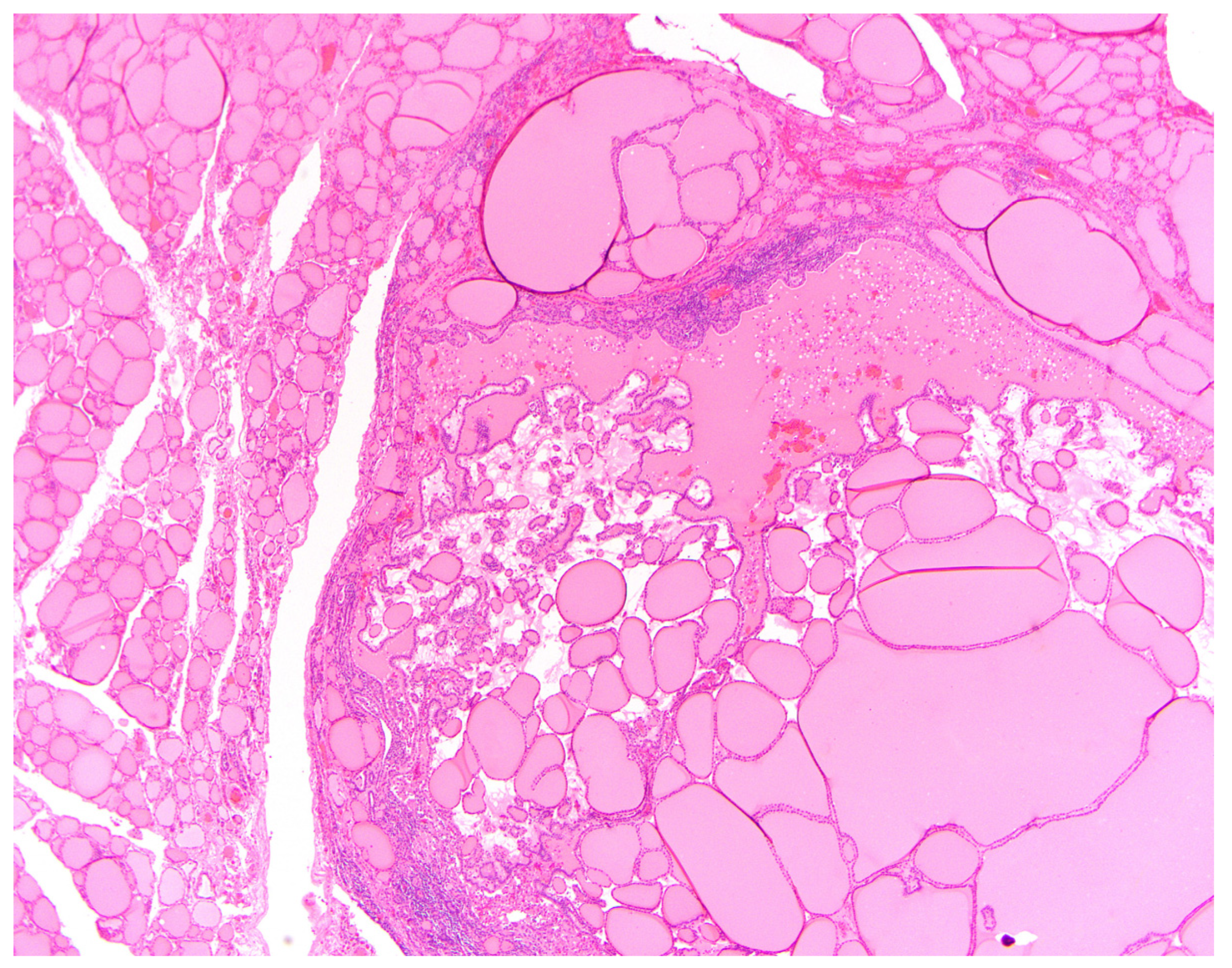 Cancers 16 00347 g008