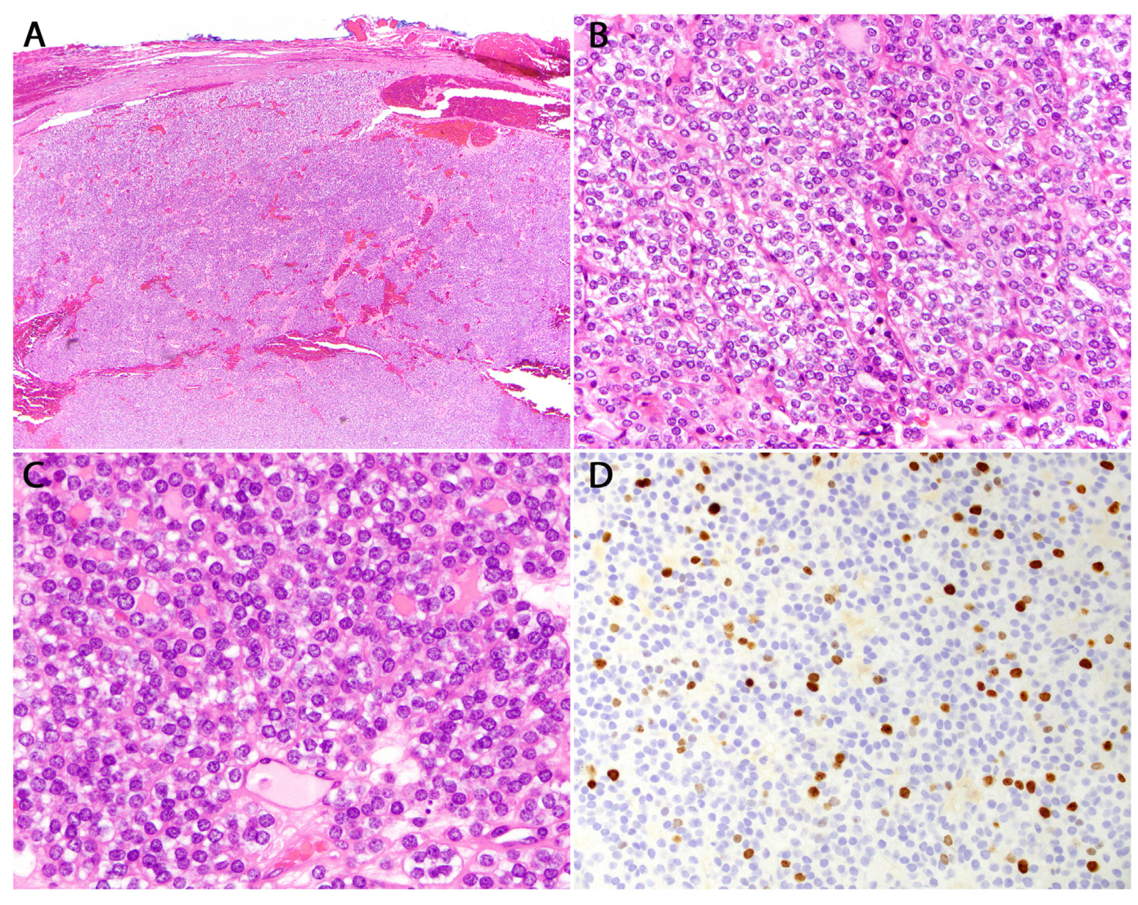 Cancers 16 00347 g010