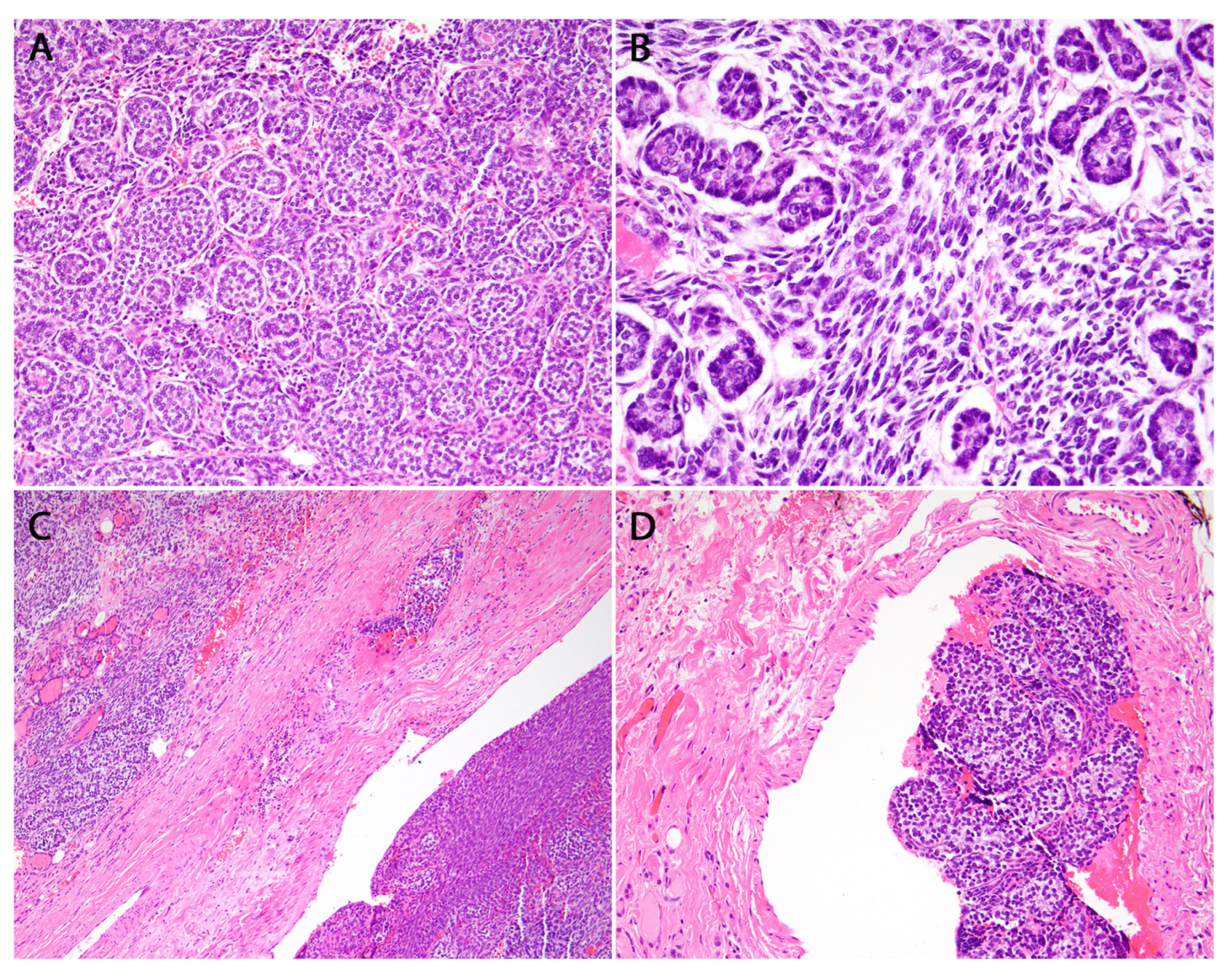 Cancers 16 00347 g011a