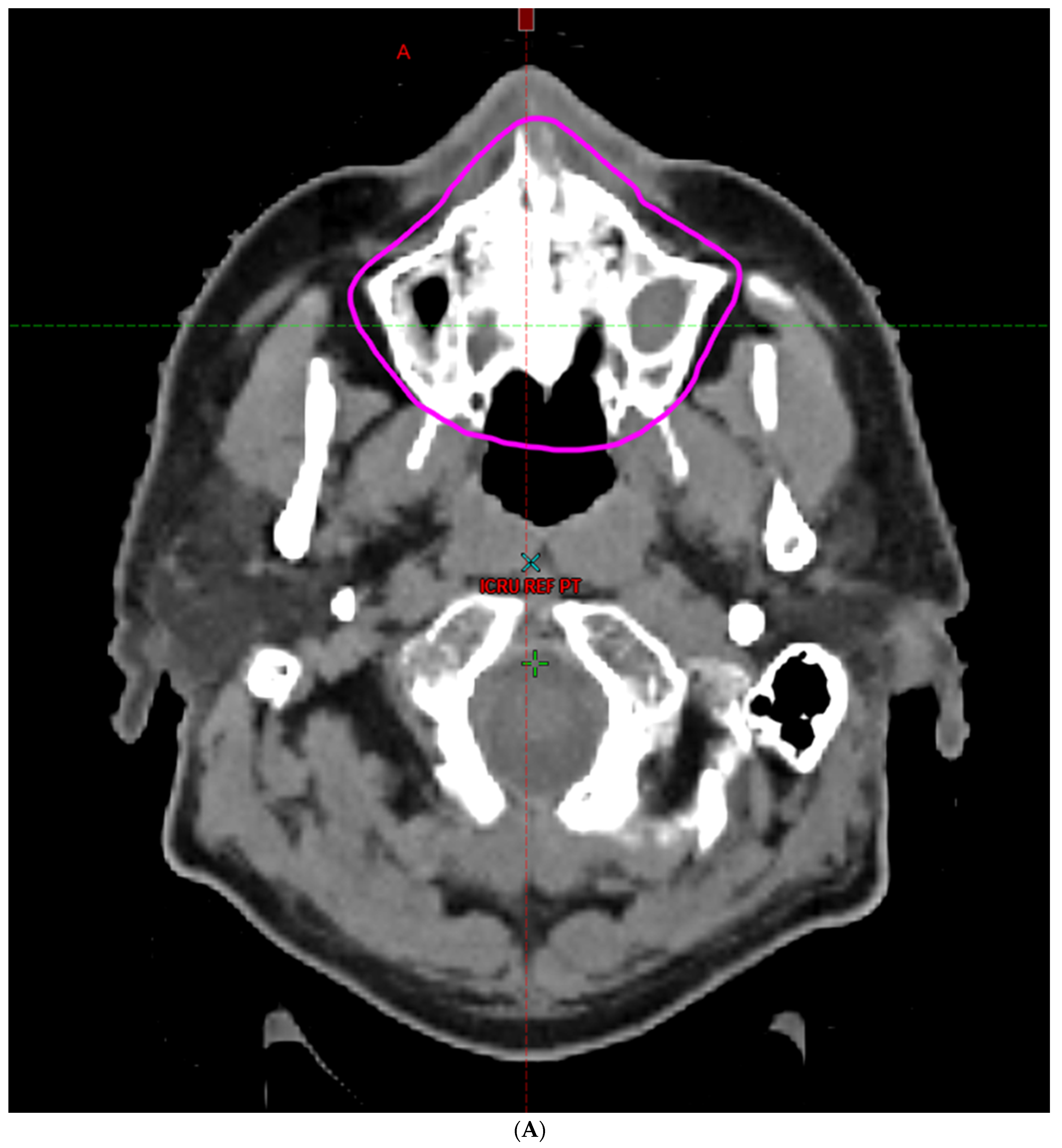 Cancers 16 00349 g002a