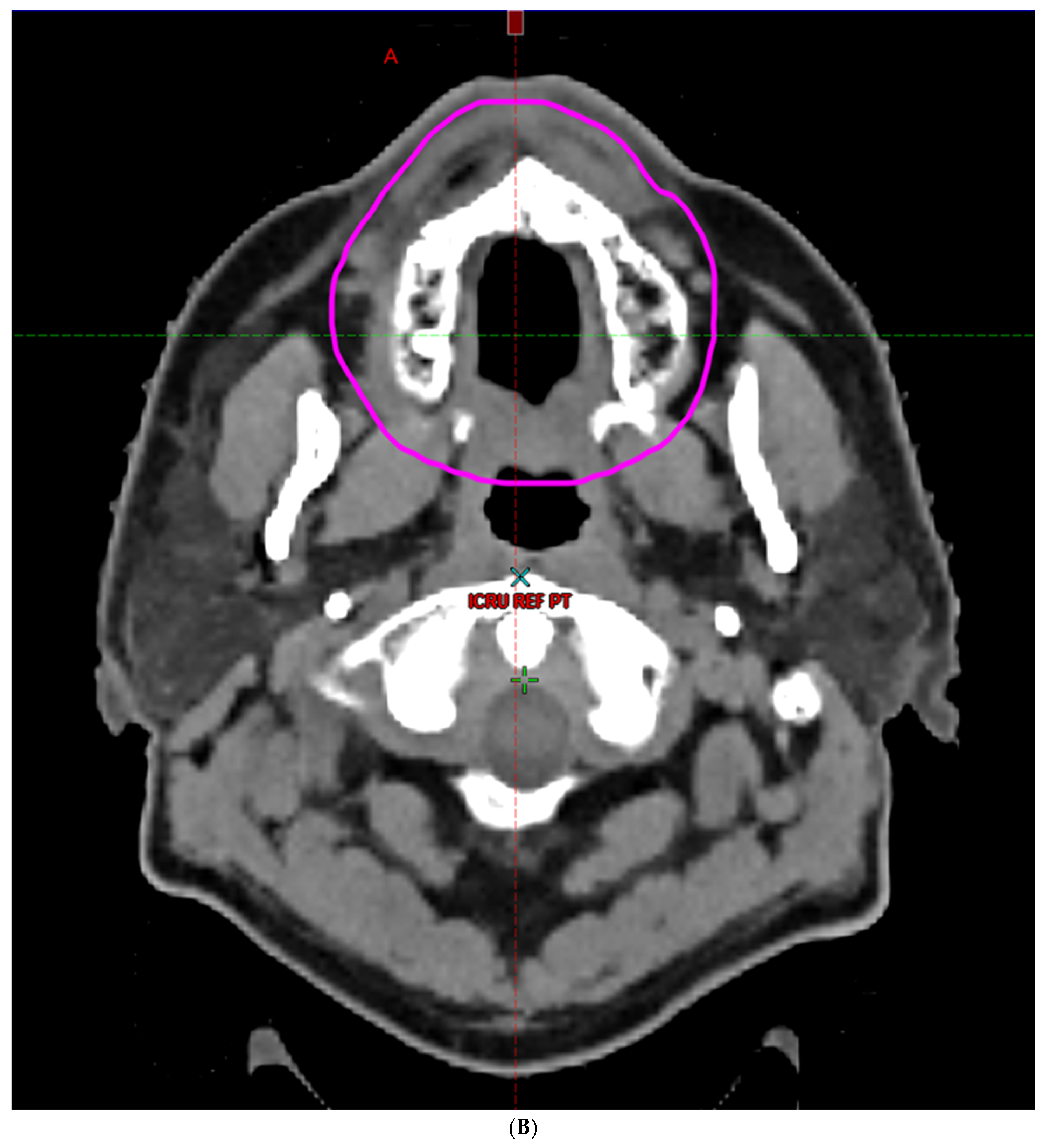 Cancers 16 00349 g002b