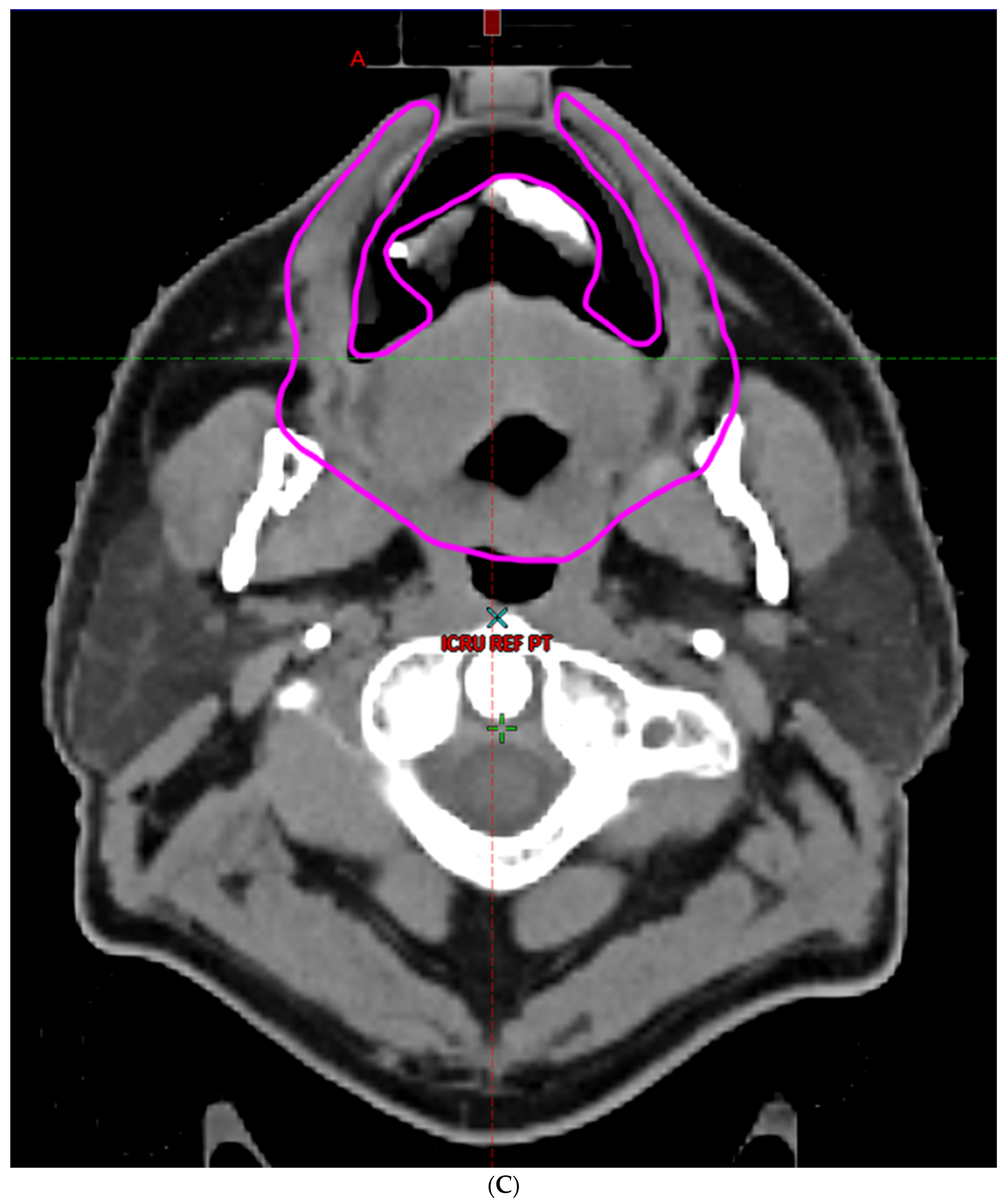 Cancers 16 00349 g002c