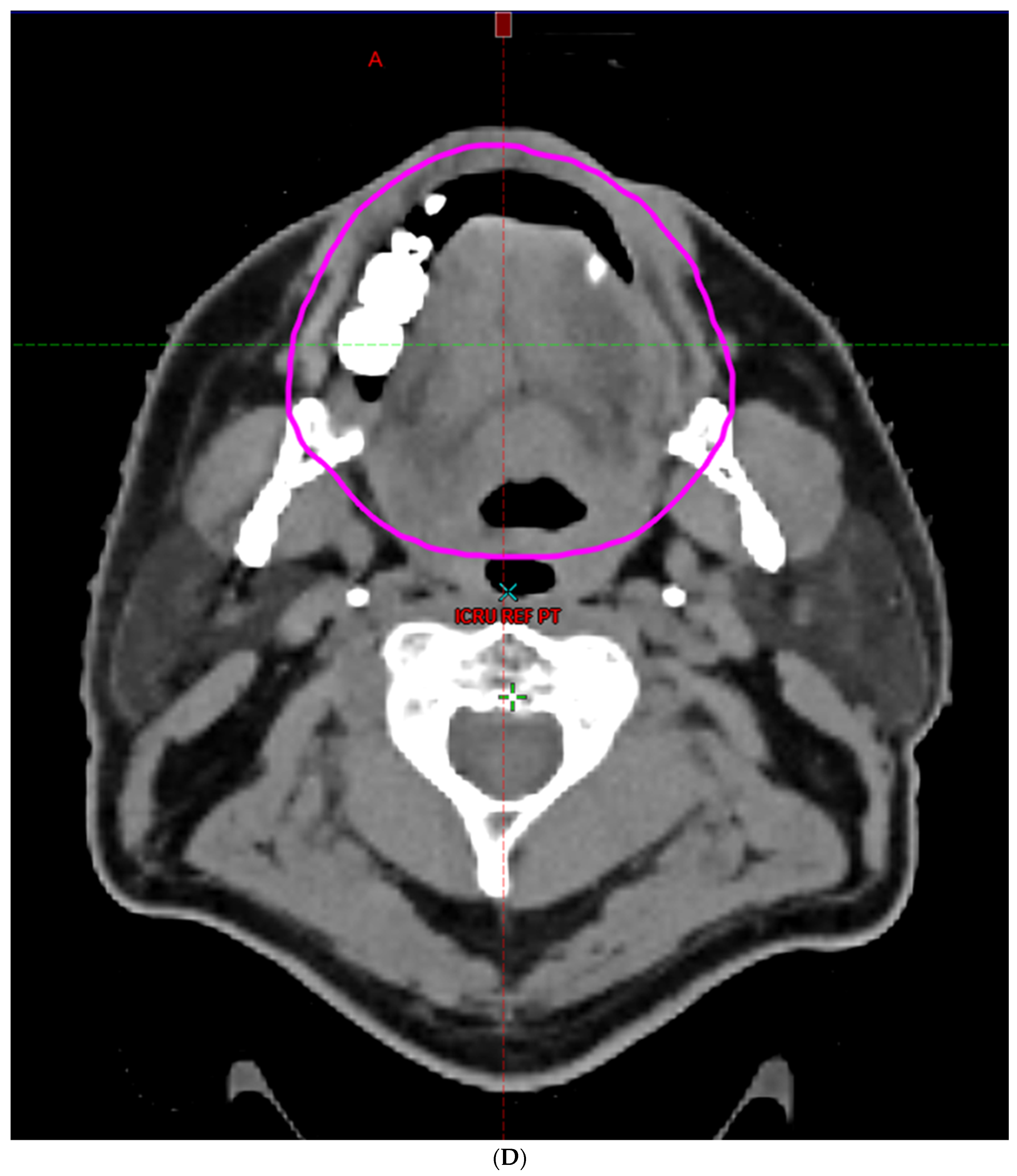 Cancers 16 00349 g002d