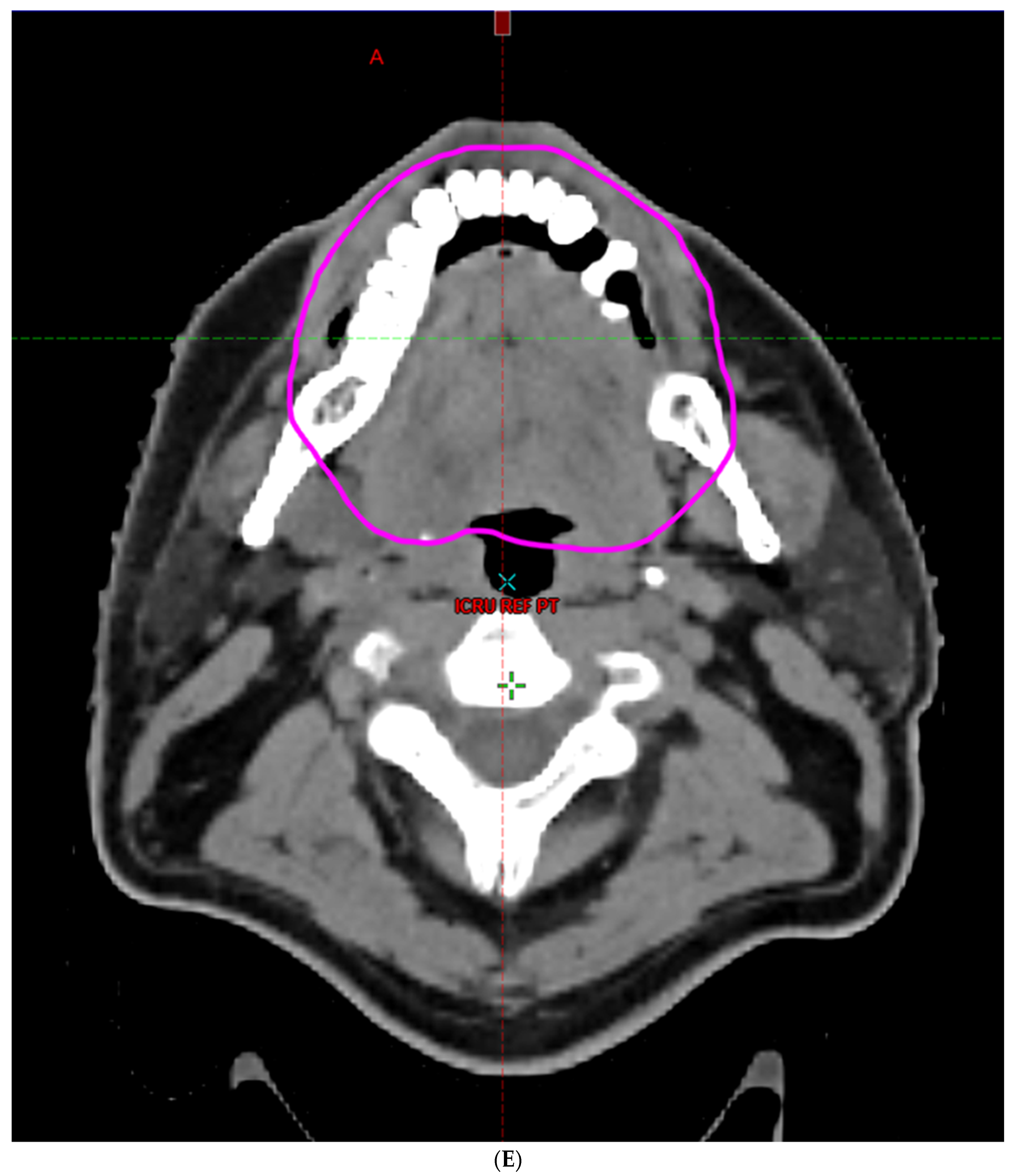 Cancers 16 00349 g002e